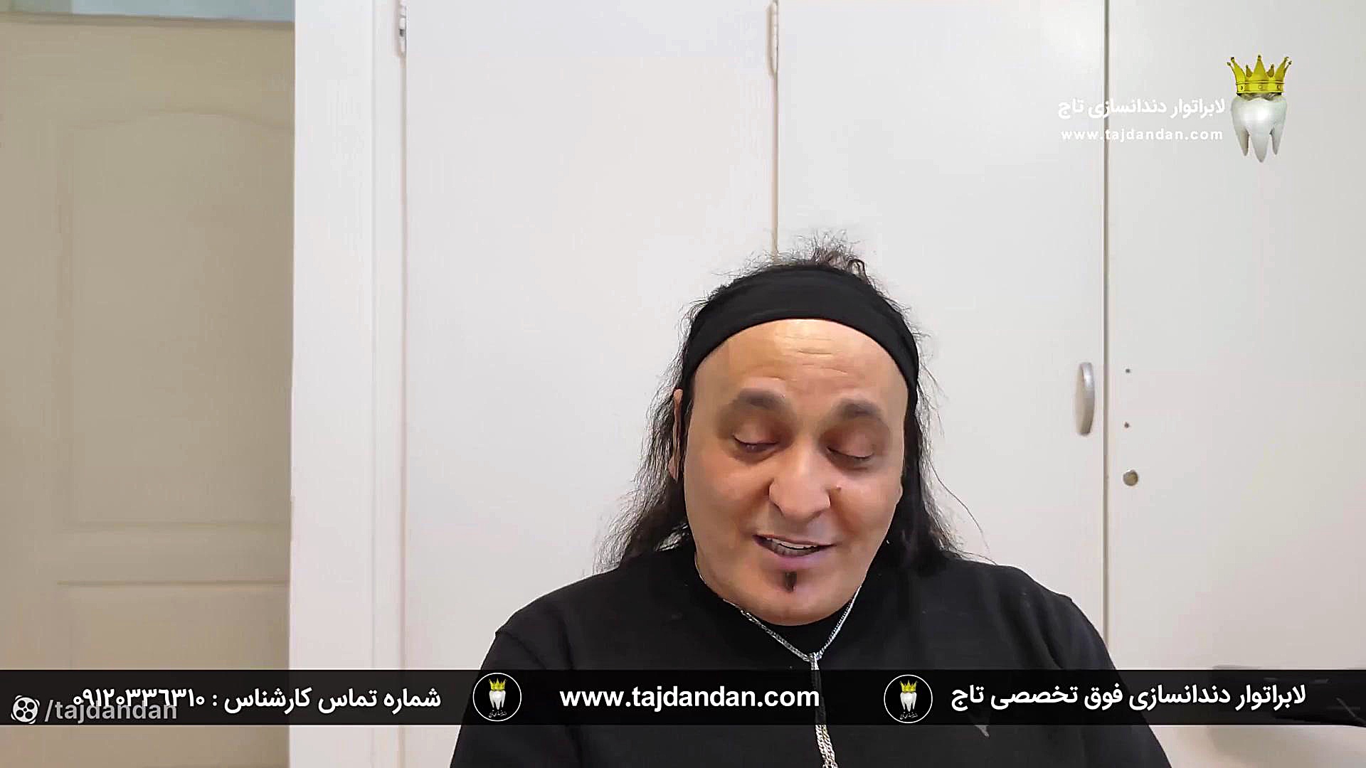 رضایت بیمار جوان اهل گرگان با تحلیل لثه شدید از پروتز دندان ایووبیس سوئیسی لیزر صورت