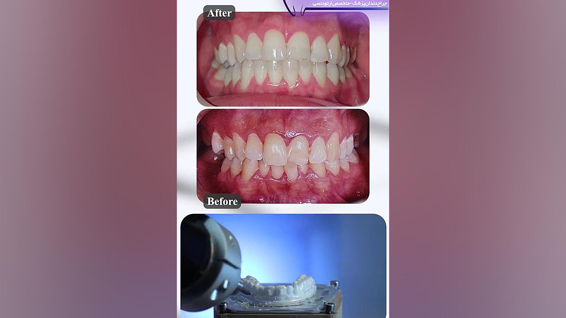 ارتودنسی دکتر ثریا یوسف نژاد متخصص ارتودنسی بابل