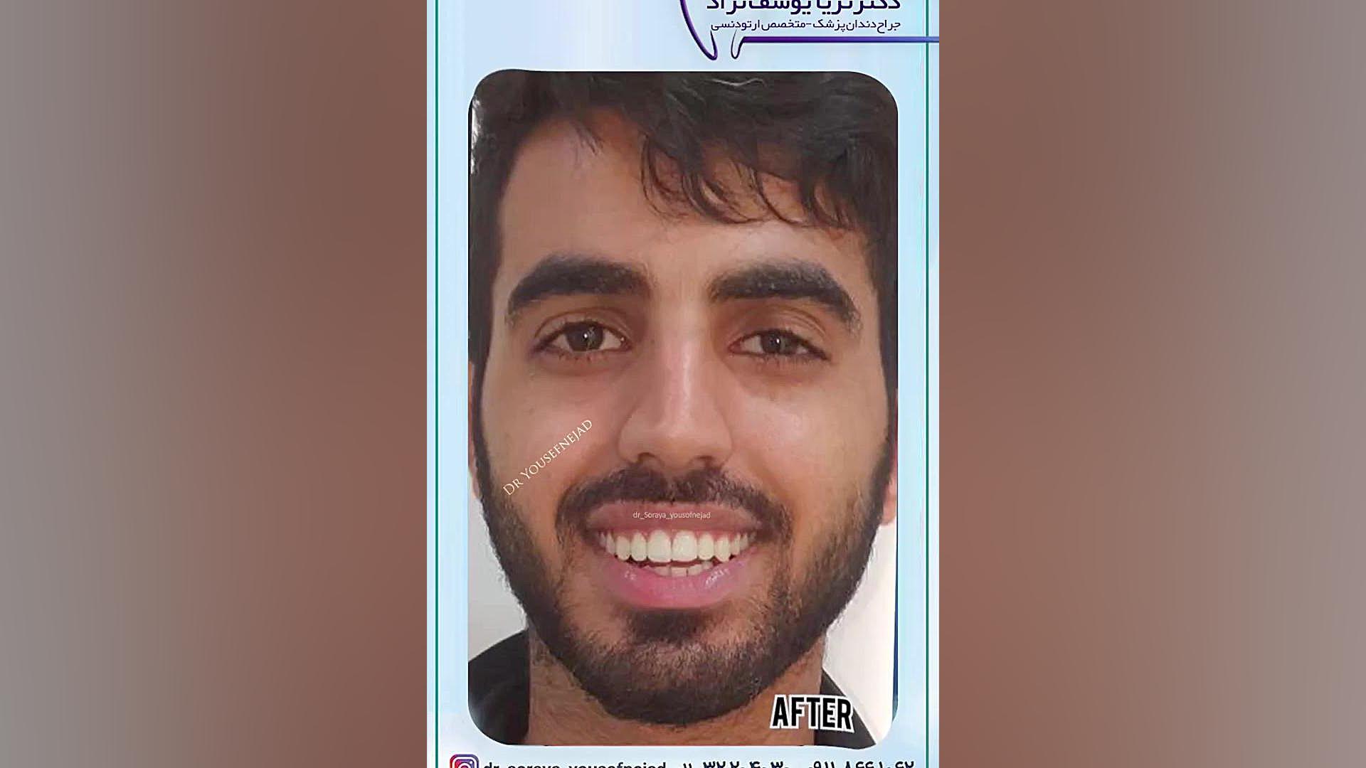 ارتودنسی دکتر ثریا یوسف نژاد متخصص ارتودنسی بابل