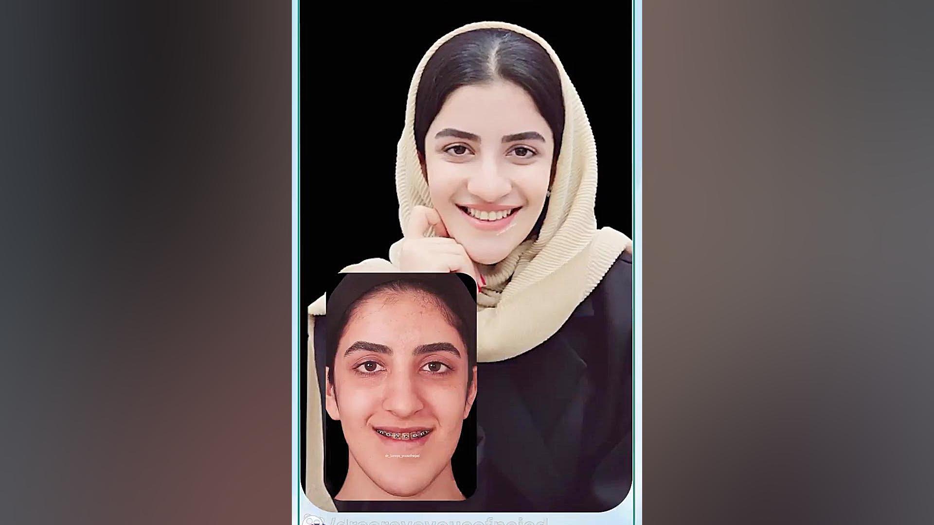 ارتودنسی دکتر ثریا یوسف نژاد متخصص ارتودنسی بابل