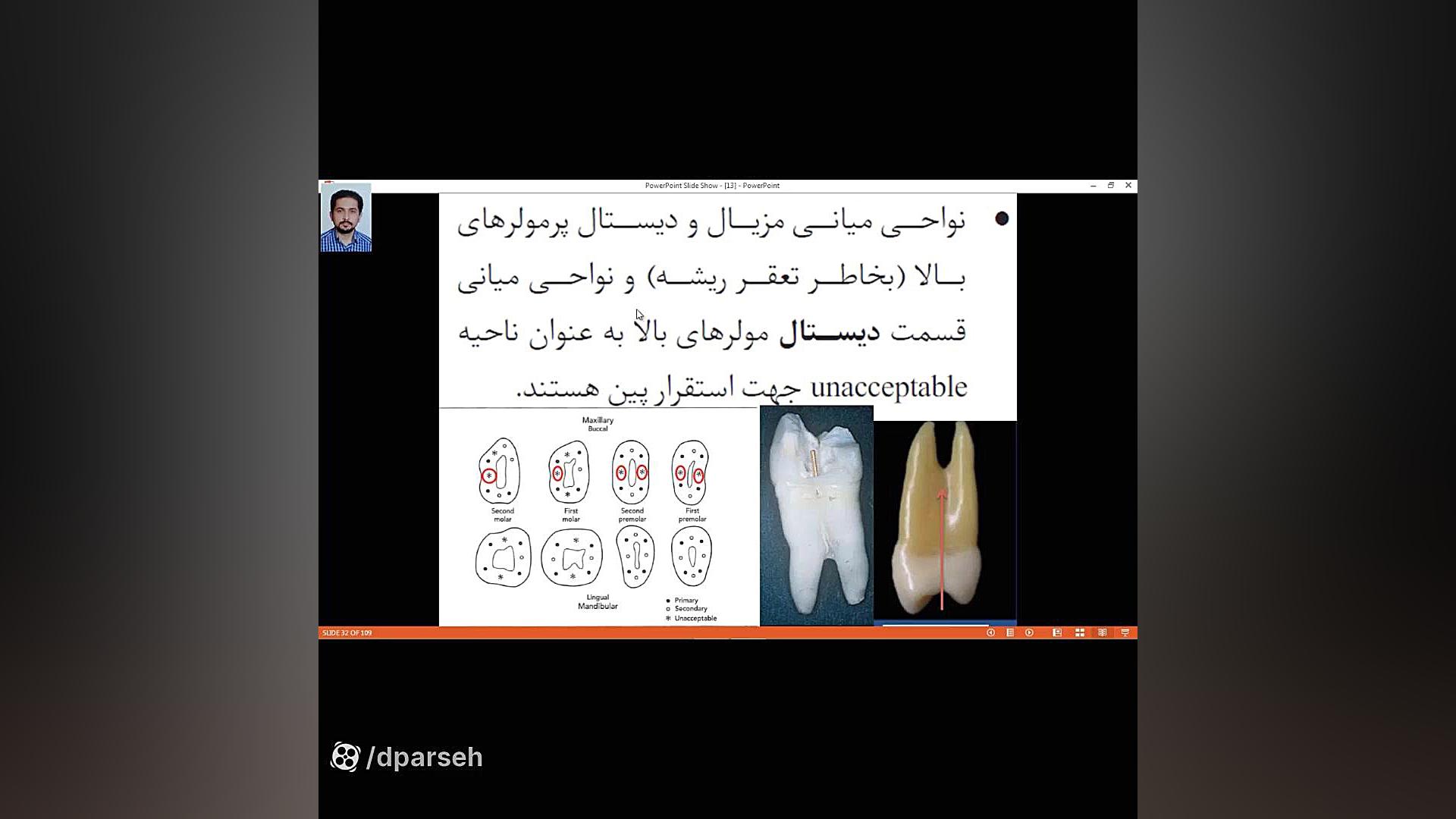 نمونه تدریس پکیج بررسی و درک مفاهیم درس پروتز ثابت آمادگی آزمون رزیدنتی1403 ایربسارتان