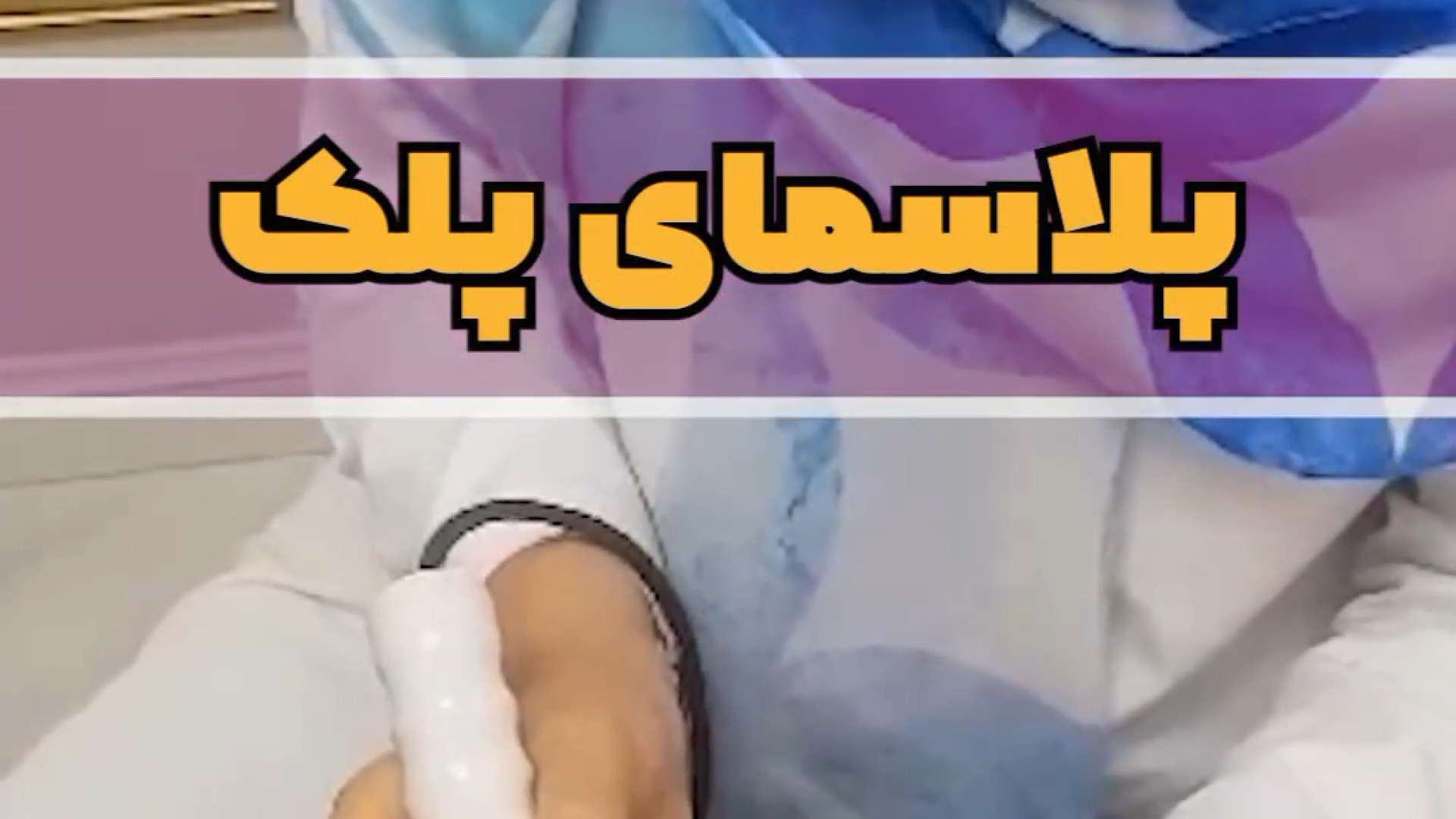 درمان افتادگی پلک دکتر حمیده آقایی