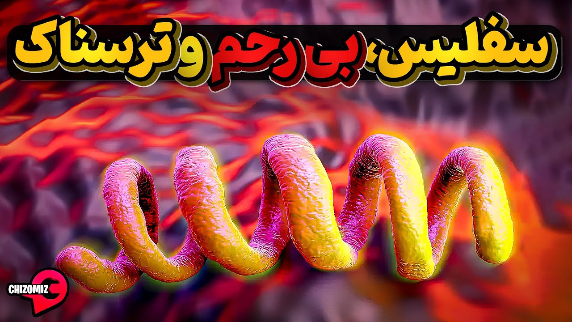 سفلیس، نیرنگ باز ترین بیماری تاریخ(آنتن_چیزومیز) اکستنشن تاج دندان