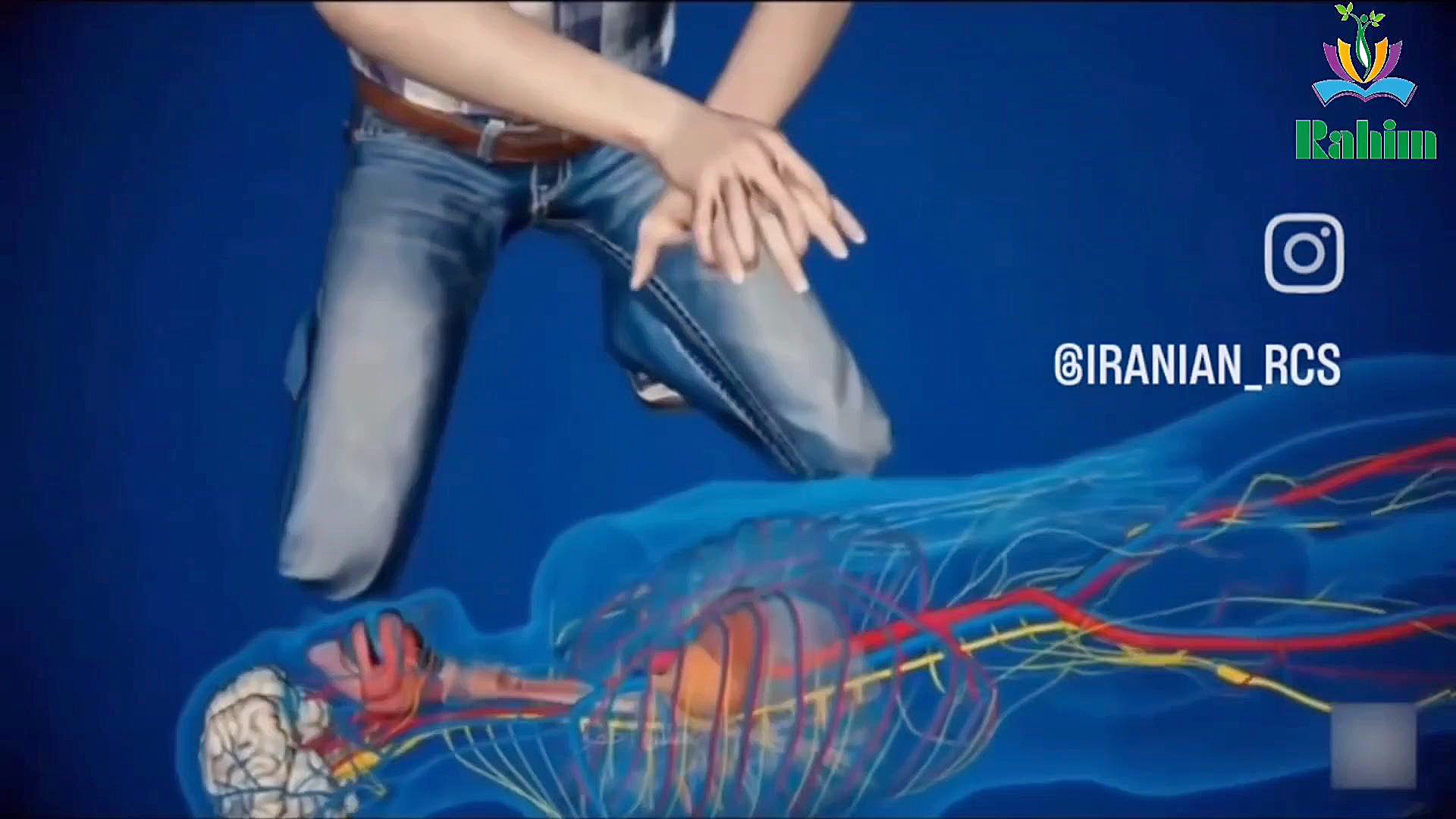 احیای قلبی ریوی (CPR) رحیم بن حسن هپوپلازی مغز استخوان