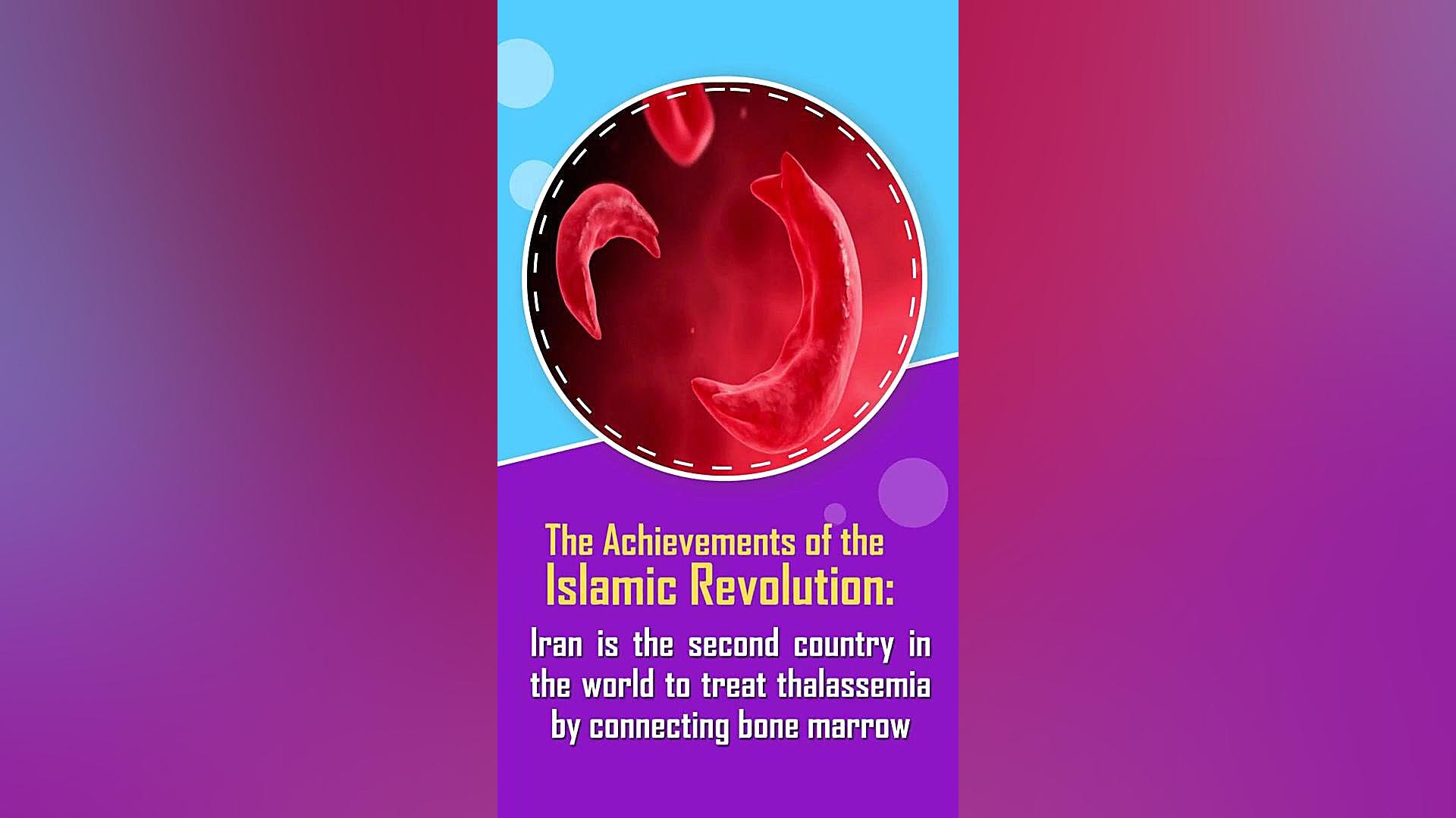 رتبه دوم ایران در میزان موفقیت درمان تالاسمی با اتصال مغز استخوان اتوپلاستی