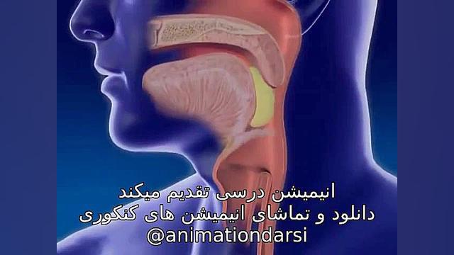 رفلاکس معده پلاسماجت