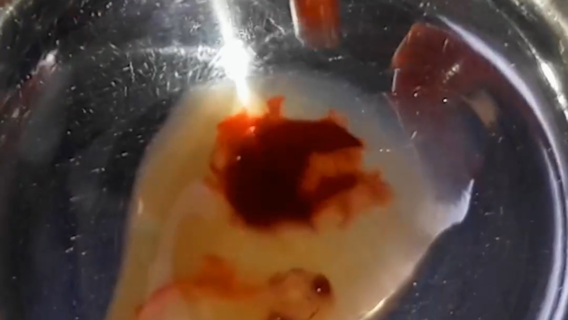 مراحل ترمیم لثه دکتر علی قمری - متخصص جراحی لثه و ایمپلنت