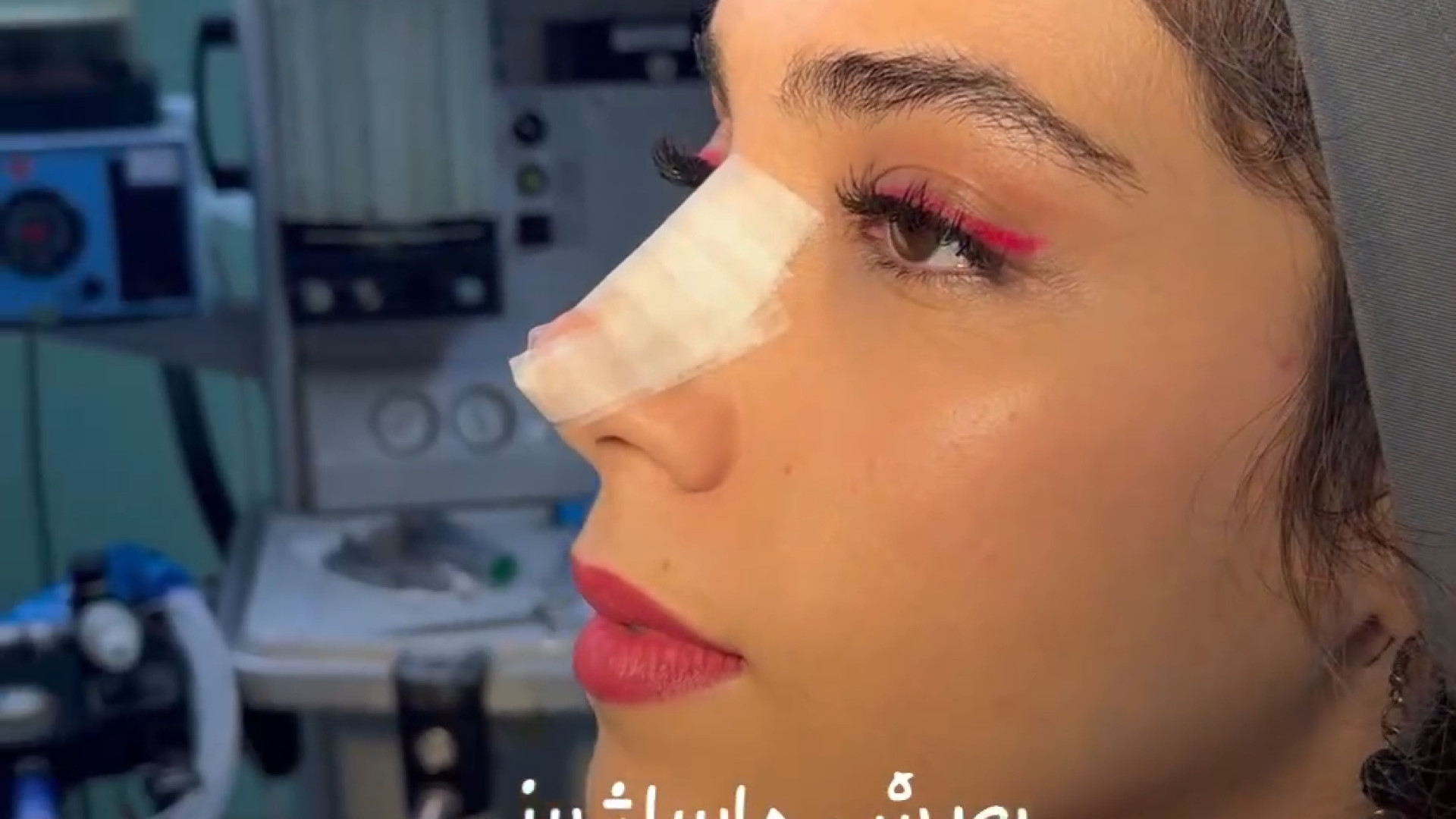 مراحل چسب زدن بینی دکتر علی شفیعی رونیزی | بهترین جراح بینی تهران
