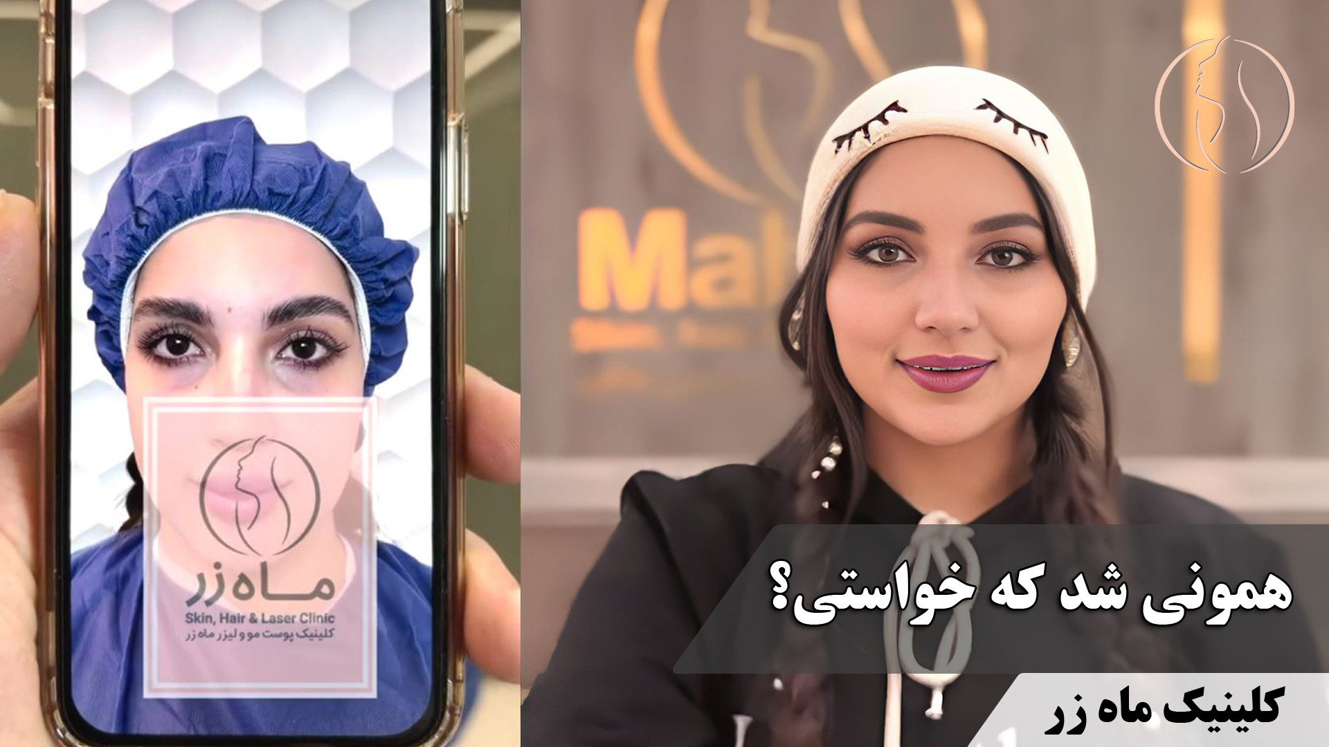 همونی شد که خواستی؟ ( کلینیک زیبایی ماه زر ) تری‌متازیدین