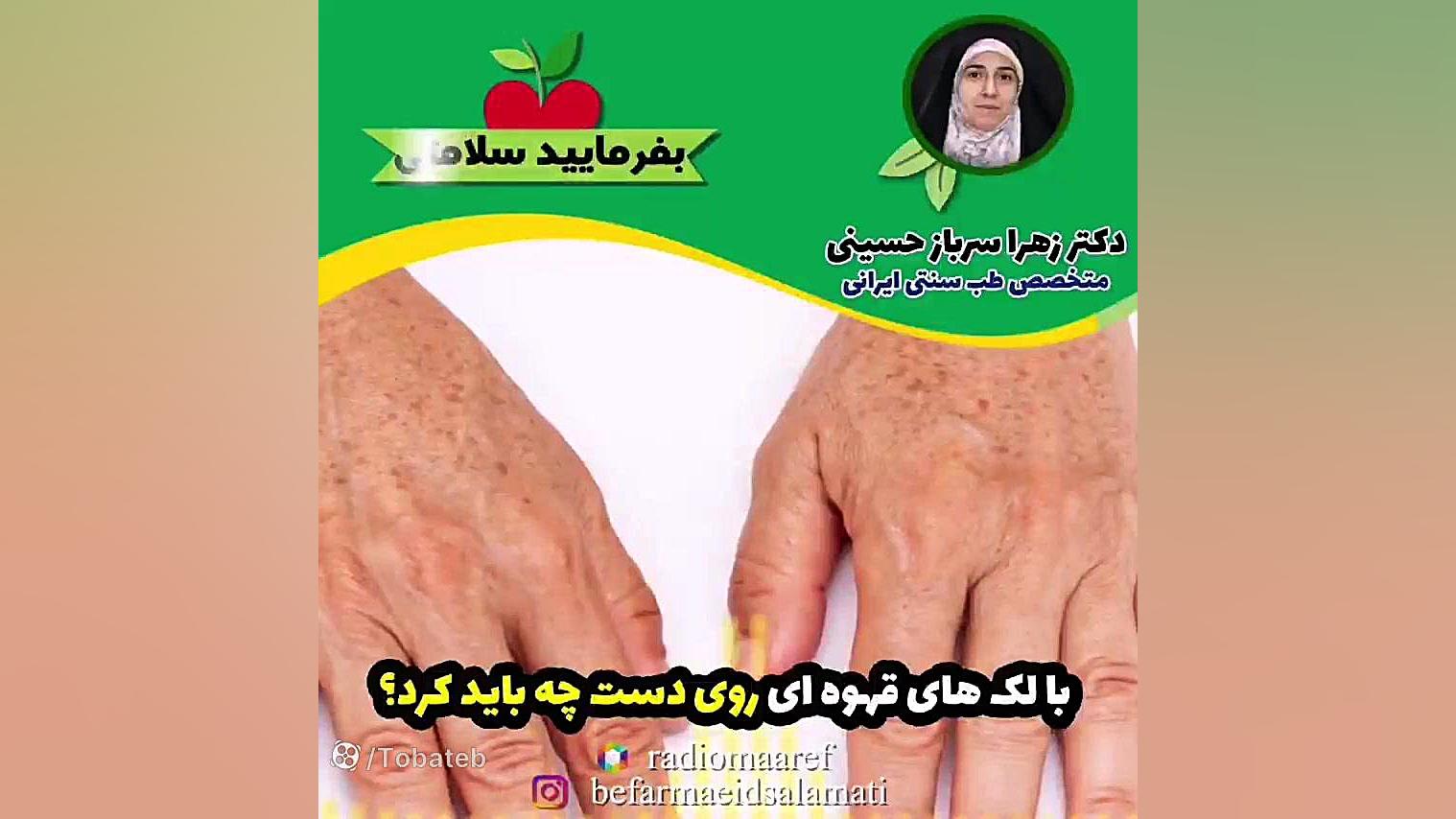 درمان لک های قهوه ای روی دست برداشتن خال گوشتی