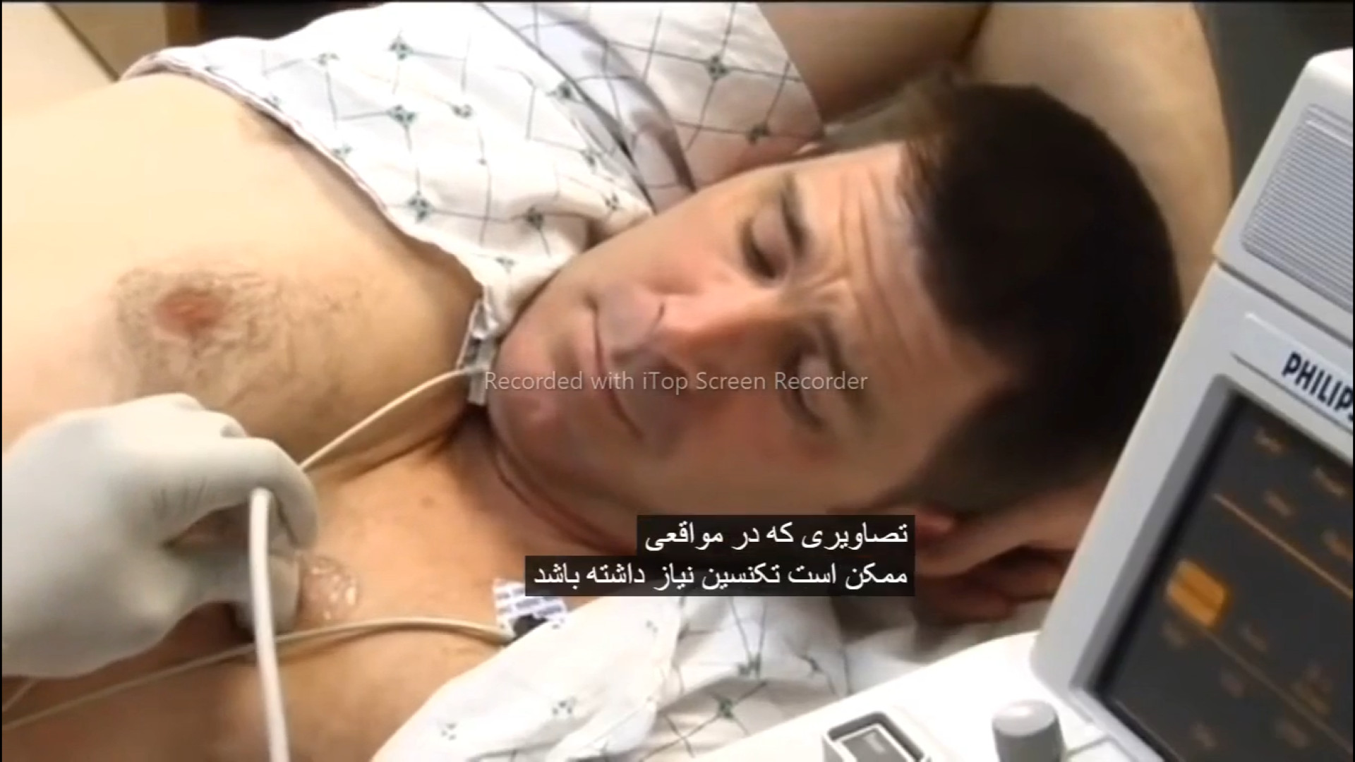 مراحل انجام تست استرس یا کوکاردیوگرافی استرس (مرکز قلب) مزوتراپی