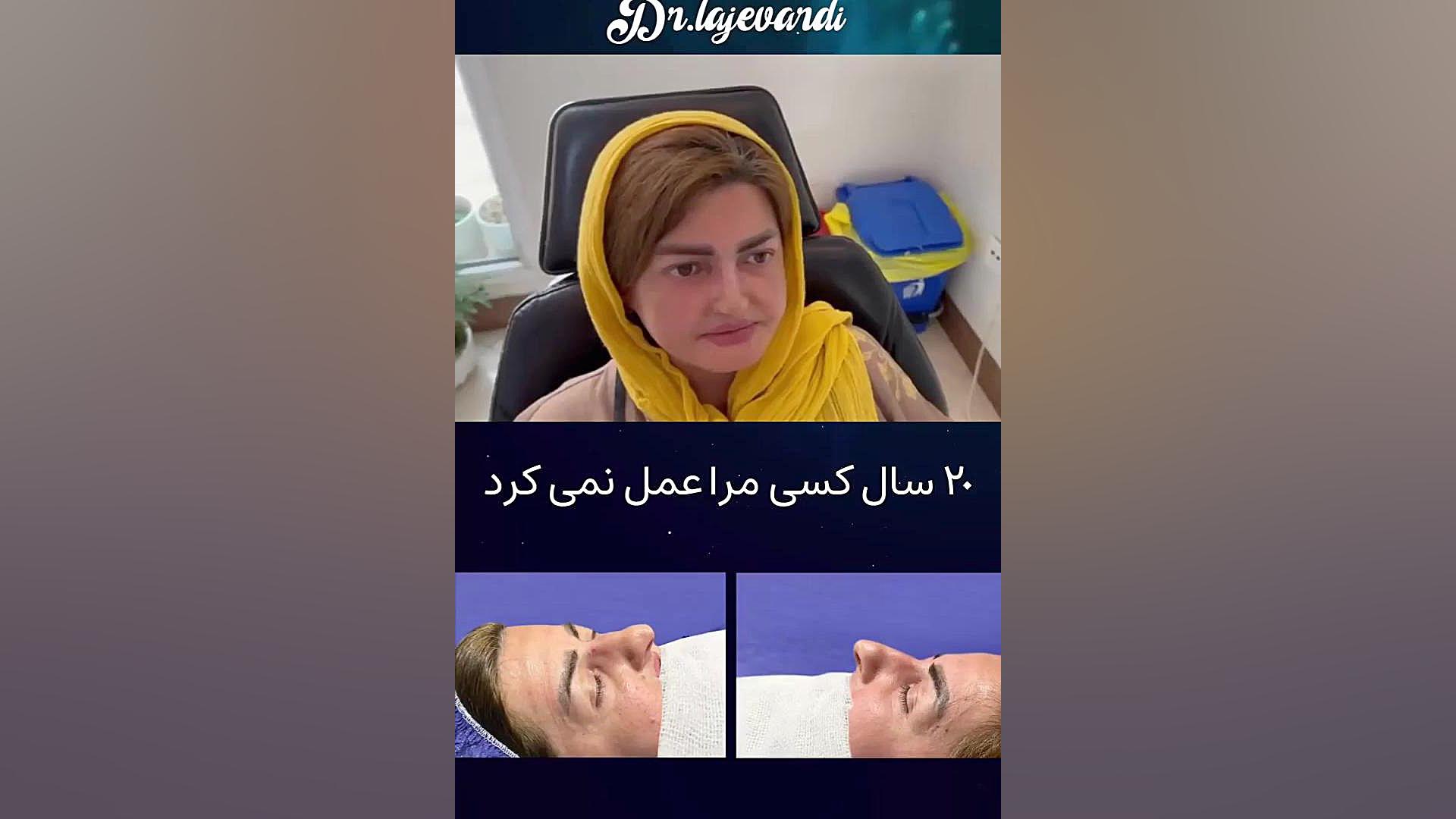 جراحی رینوپلاستی بهجو با ۳۰ درصد ریه و تزریق مزوژل و فیلر لب کلیپ