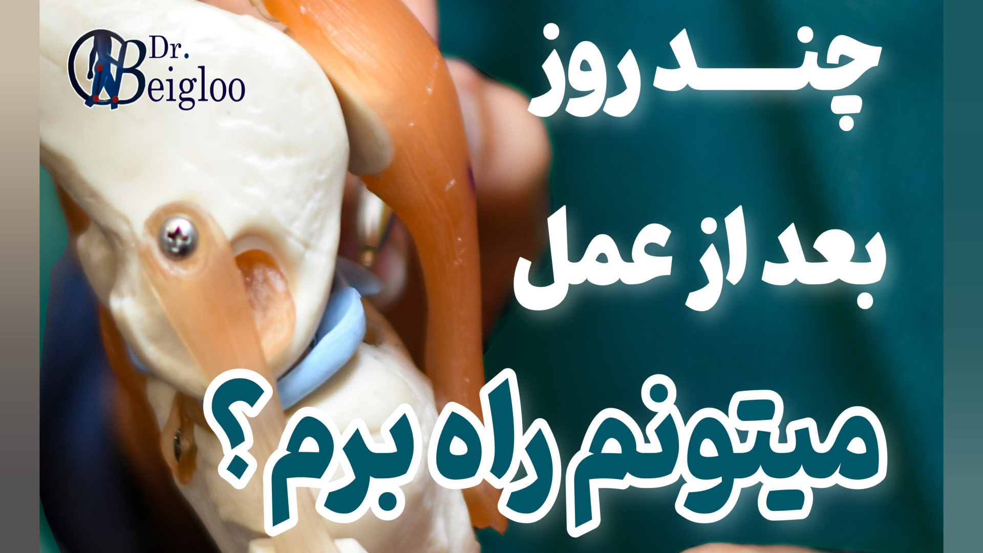 چند روز بعد از عمل میتونم راه برم ؟ دکتر محمود جعفر بیگلو
