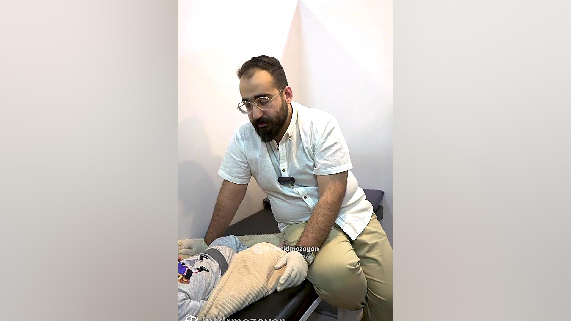 درمان سندرم موبیوس در کودکان پریناز ایزدیار