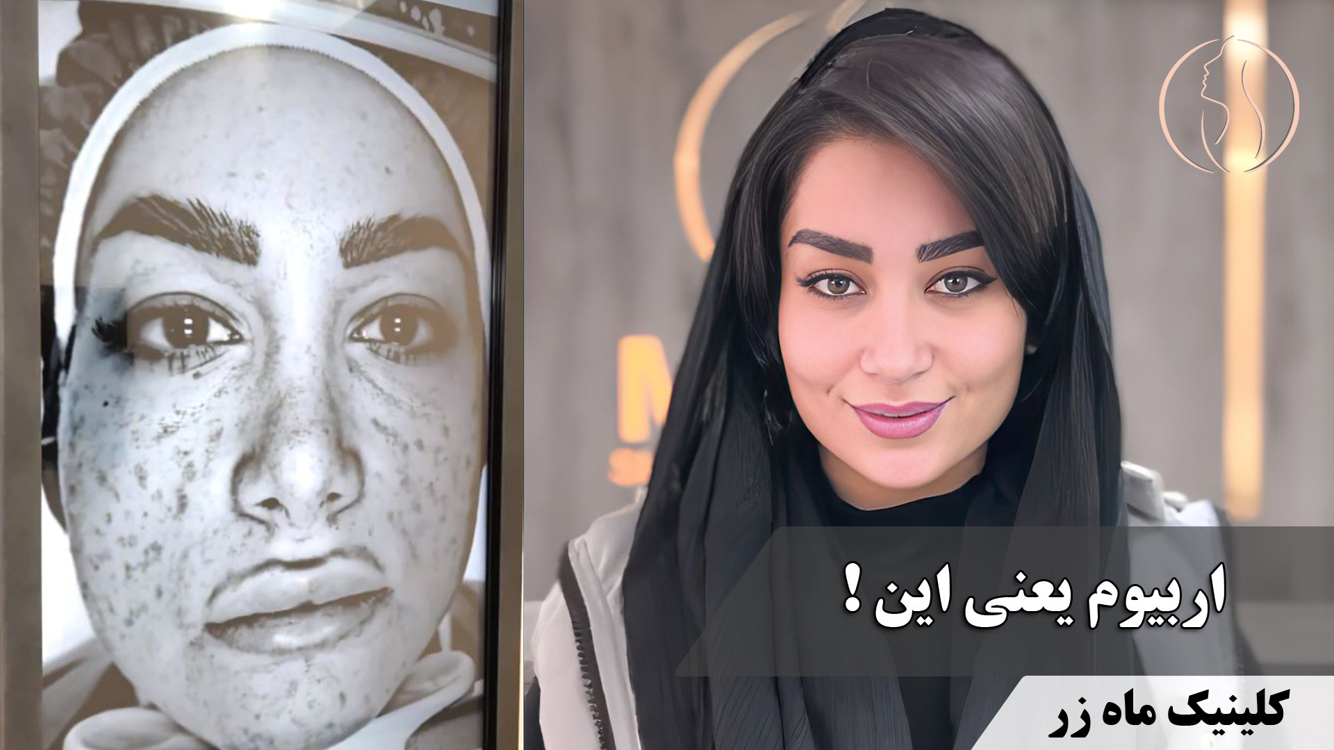 گوش کن ( کلینیک زیبایی ماه زر ) لیزر مو