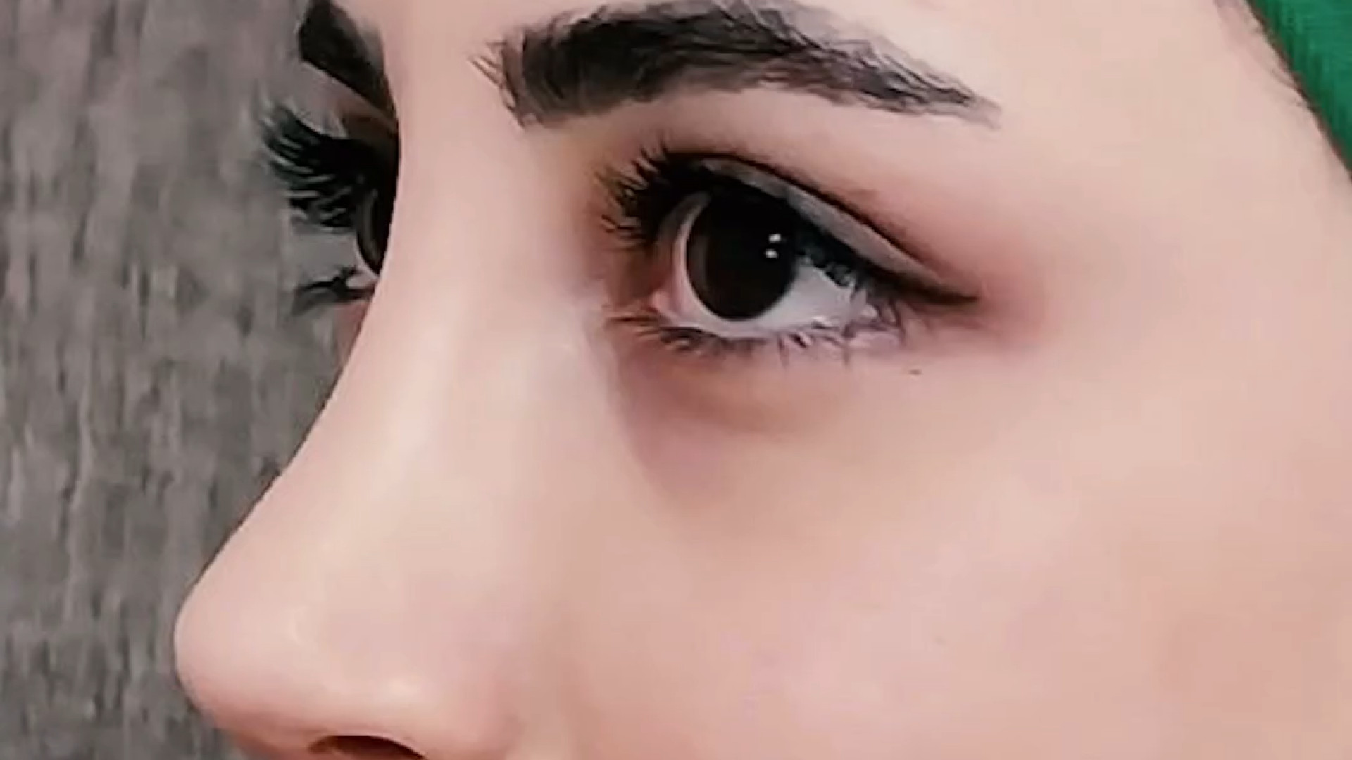 نتیجه عمل بینی دکتر فاطمه مختاری فر جراح بینی در لرستان