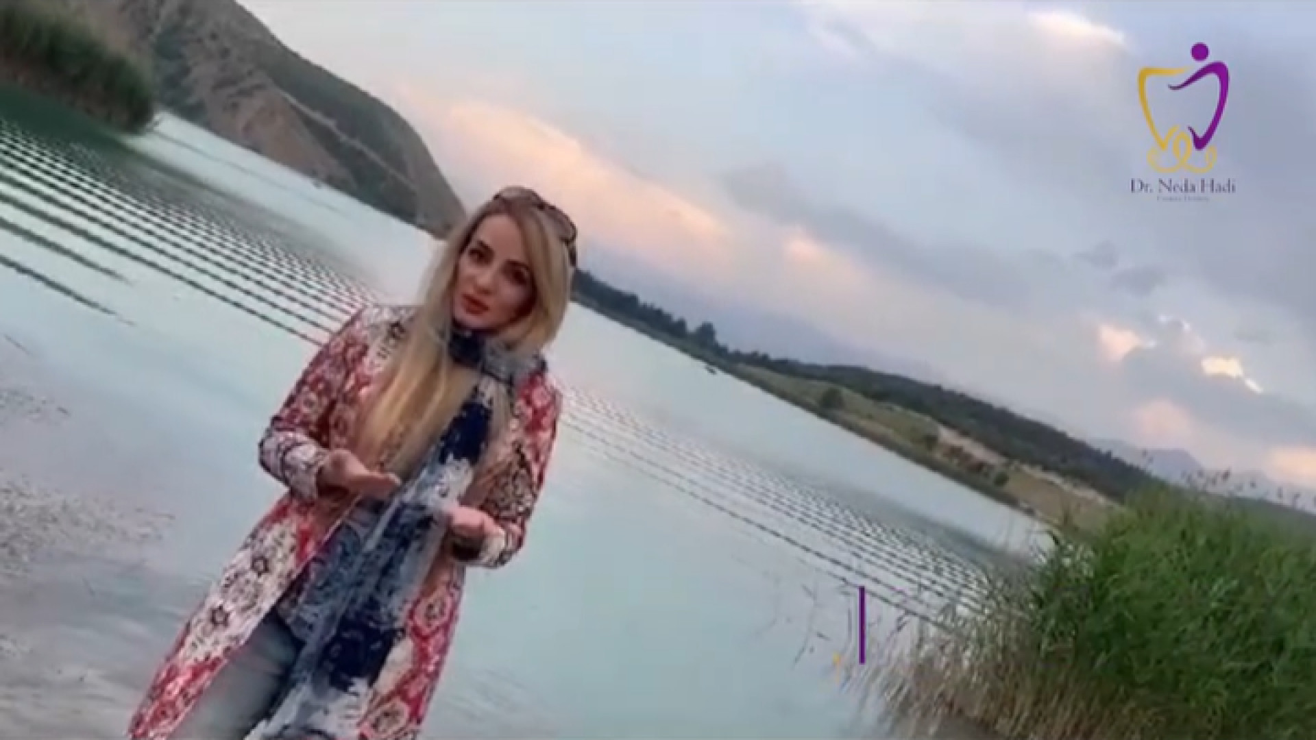 درمان دندان قروچه دکتر ندا هادی-دندانپزشک زیبایی