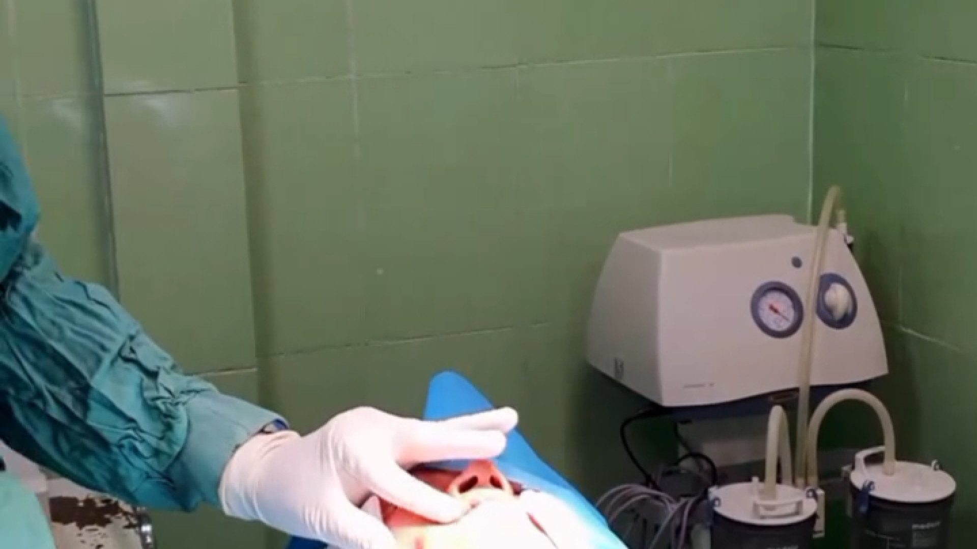 جوانسازی صورت با تزریق چربی پزشکی کوهستان