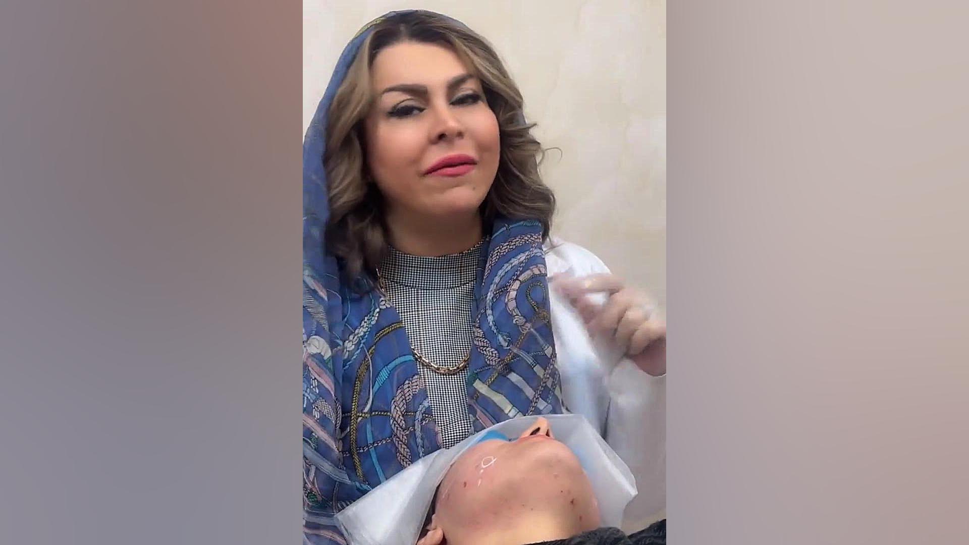 رفع غبغب و بوکال فت با لیزر اندولیفت دکتر فرحناز زینعلی - متخصص پوست، مو، زیبایی زنجان
