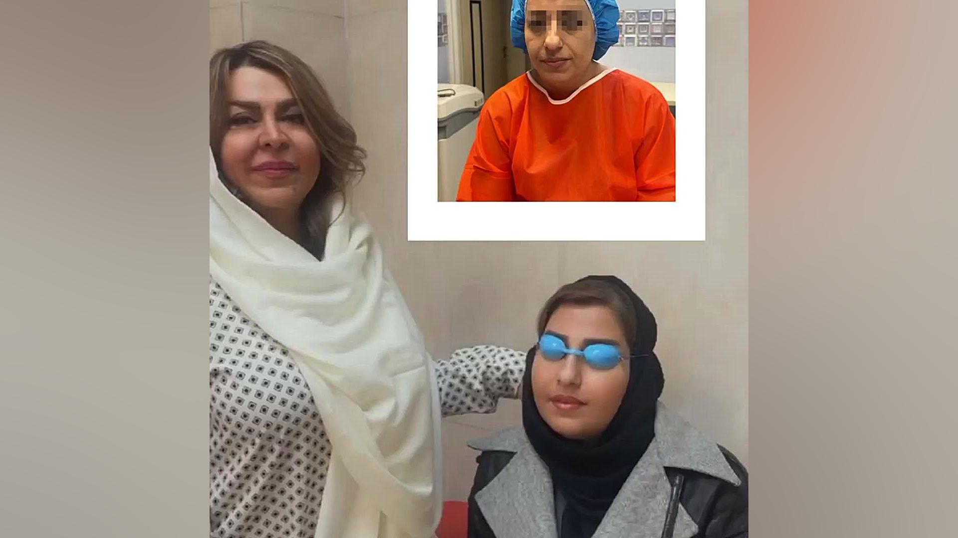 نتیجه عالی تزریق چربی از بدن به صورت سیستم نانواینژکتور