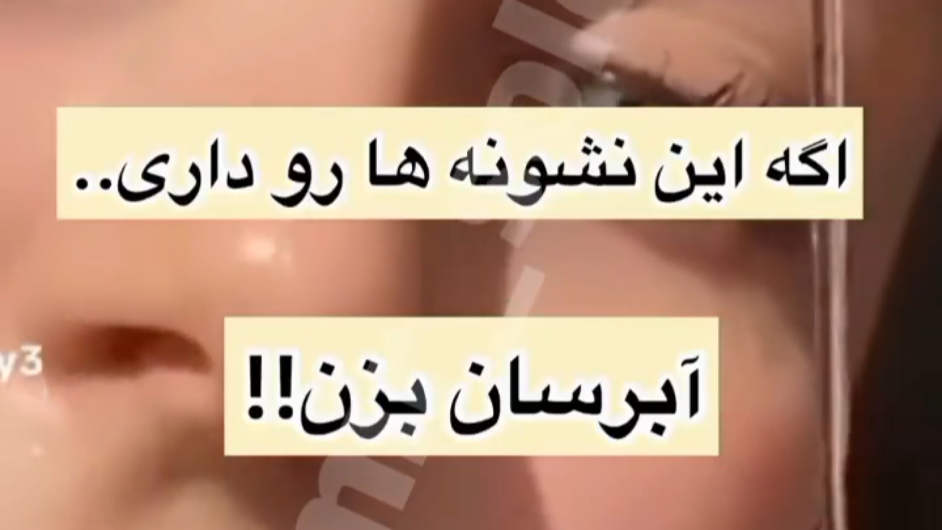 نشانه های کم آبی پوست دکتر امیر سلیمانی