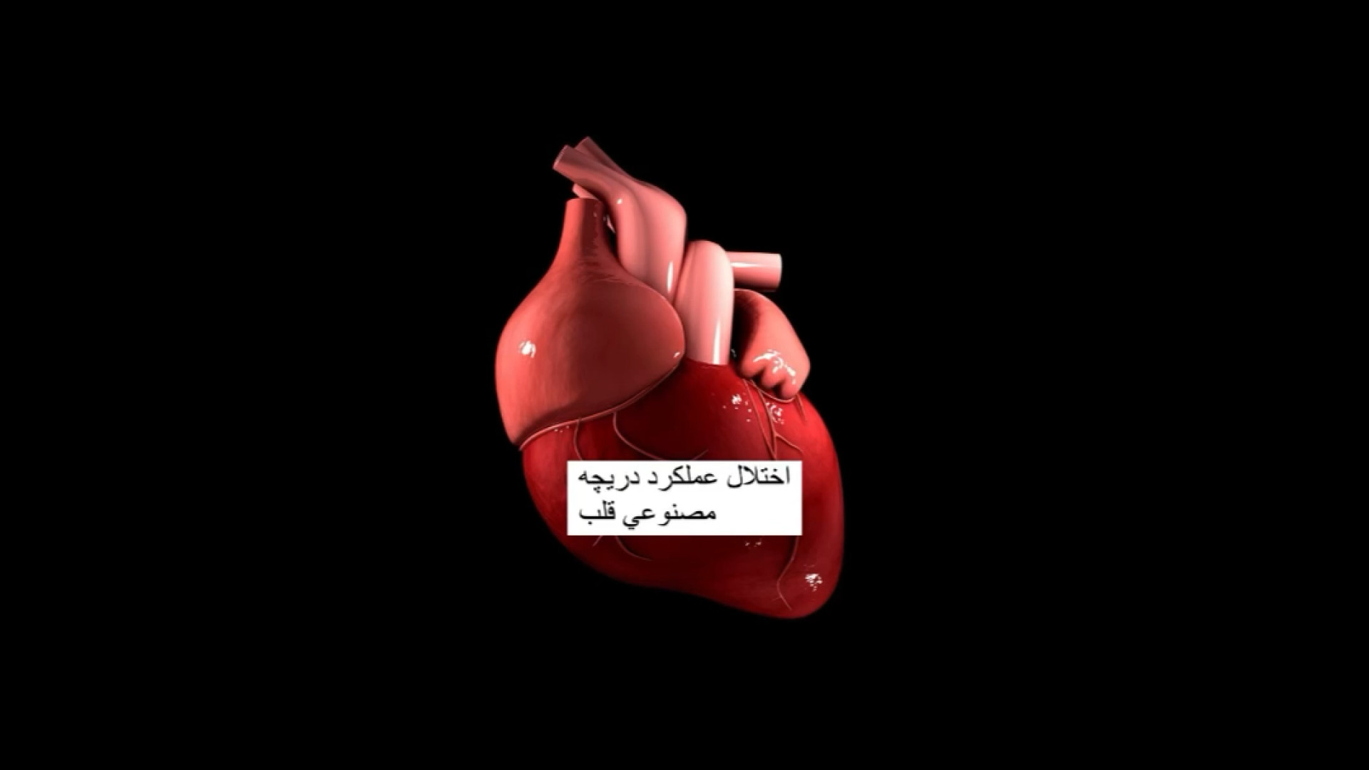 اختلال عملكرد دريچه مصتوعي قلب-دكترحدادزاده کلینیک زیبایی