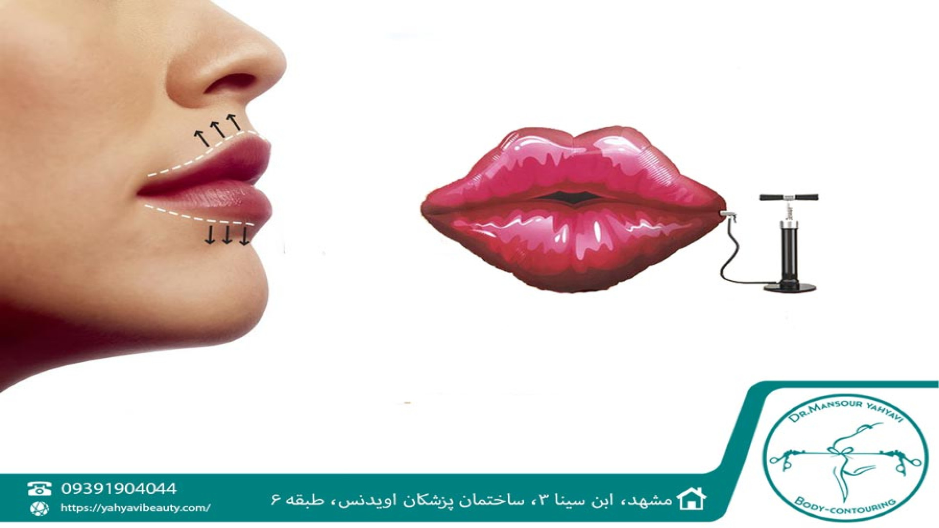 فیلم تزریق ژل و چربی (زاویه سازی فک و صورت، پروتز لب، دست) تزریق چربی