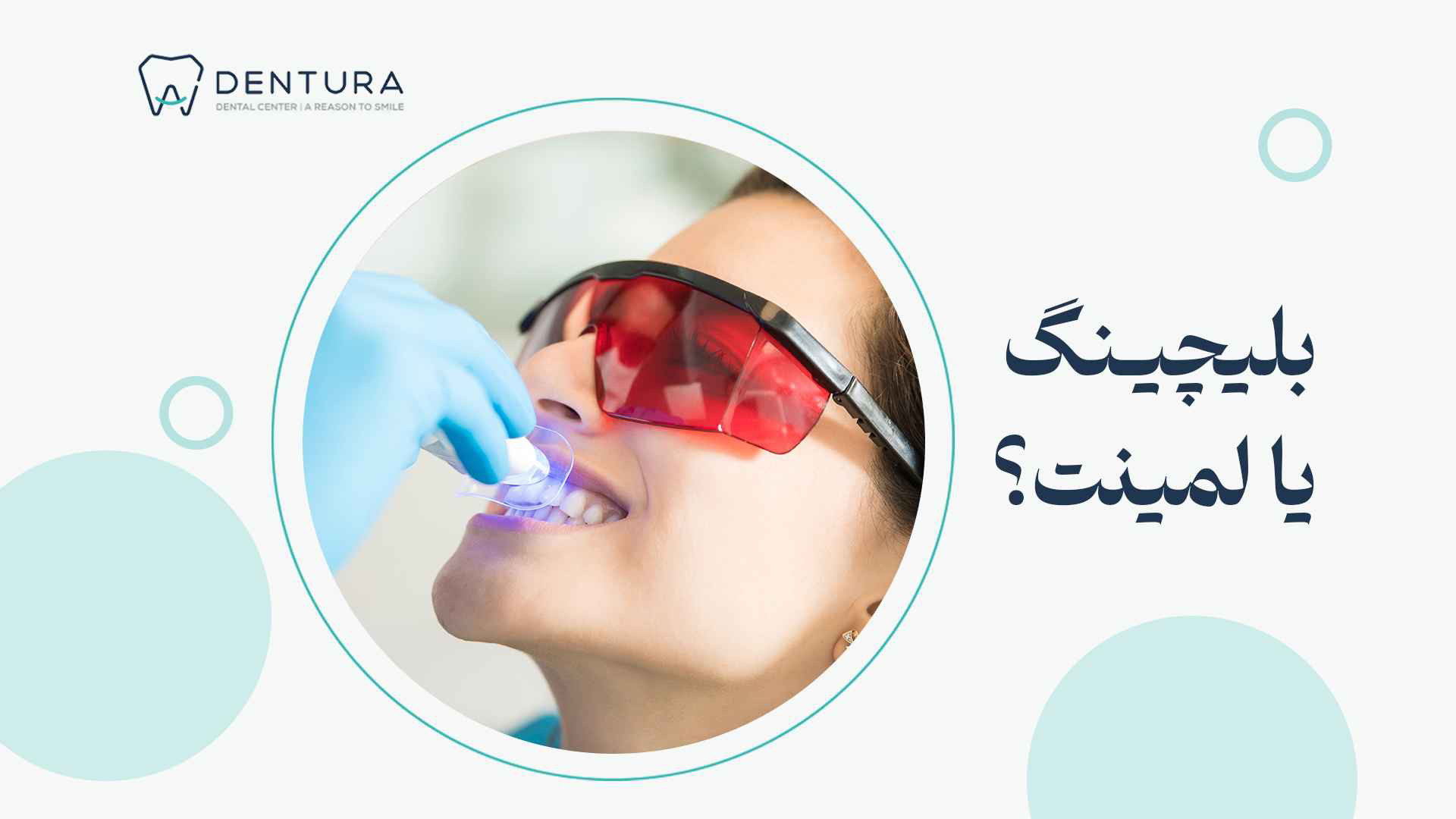 بلیچینگ یا لمینت؟ پزشکی زیرآب
