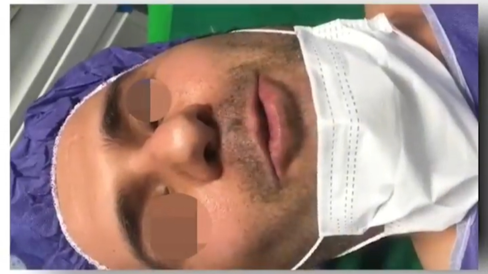 جراحی زیبایی بینی دکتر مهدی قدیری