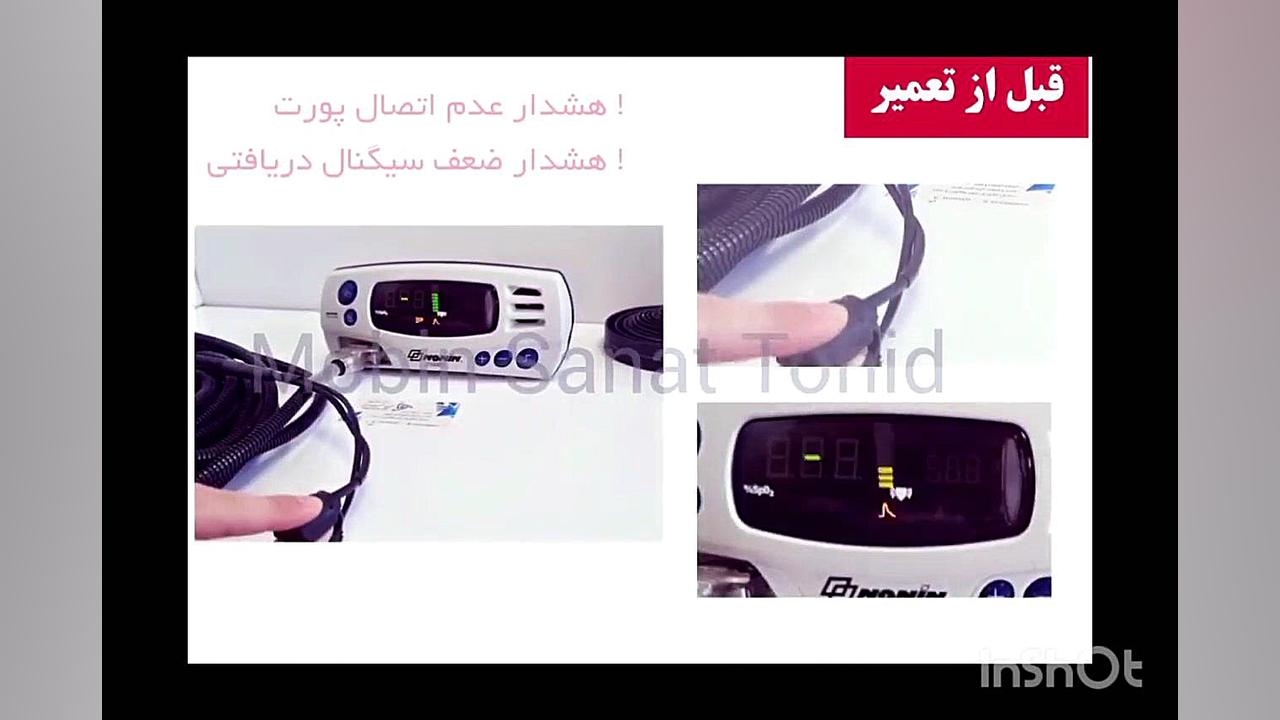 تعمیر کابل پالس اکسیمتر MRI ابرسانی پوست