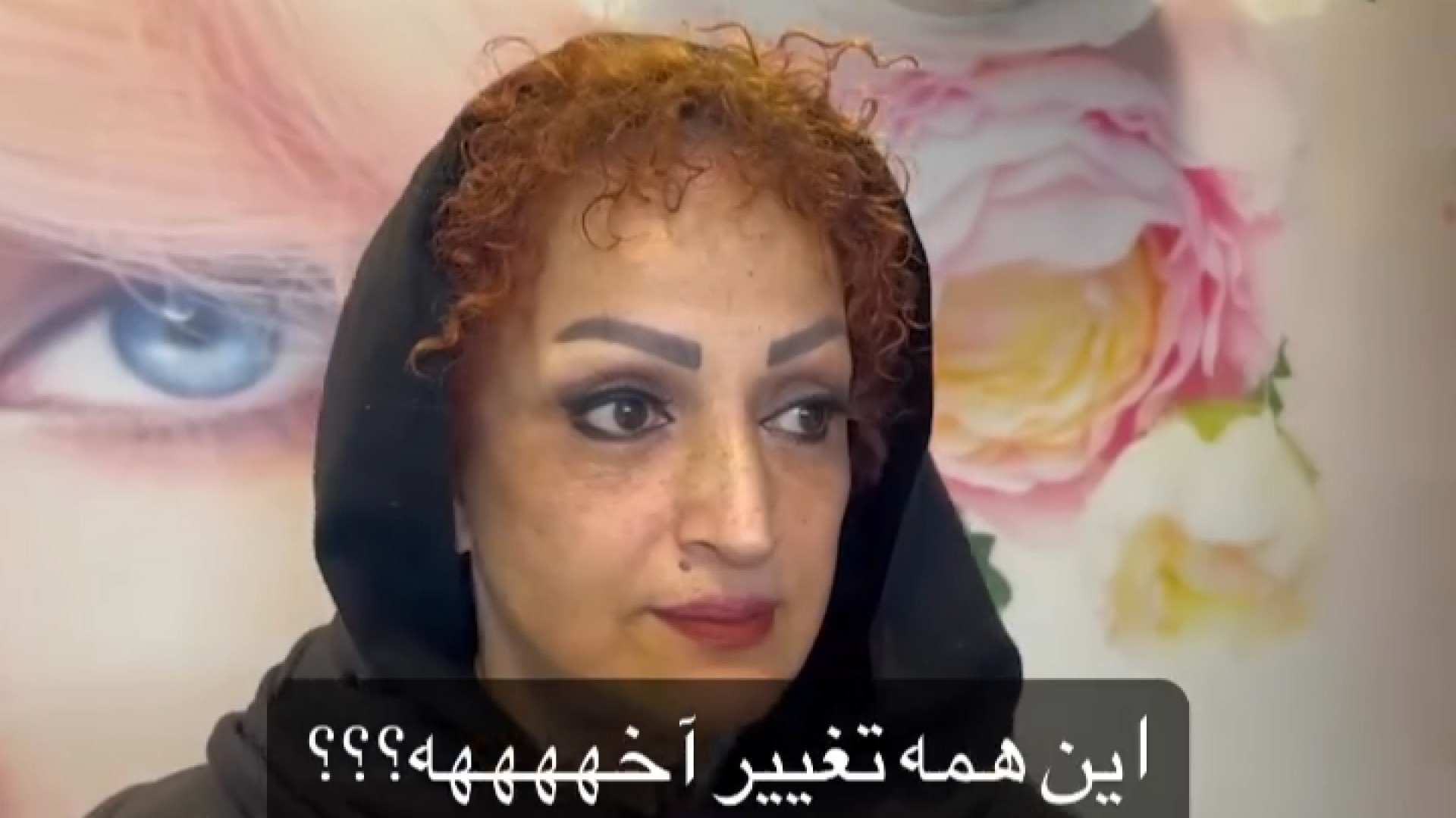 ۴ ماه پس از لیفت صورت دکتر شاهین بهجو - فوق تخصص جراحی پلاستیک