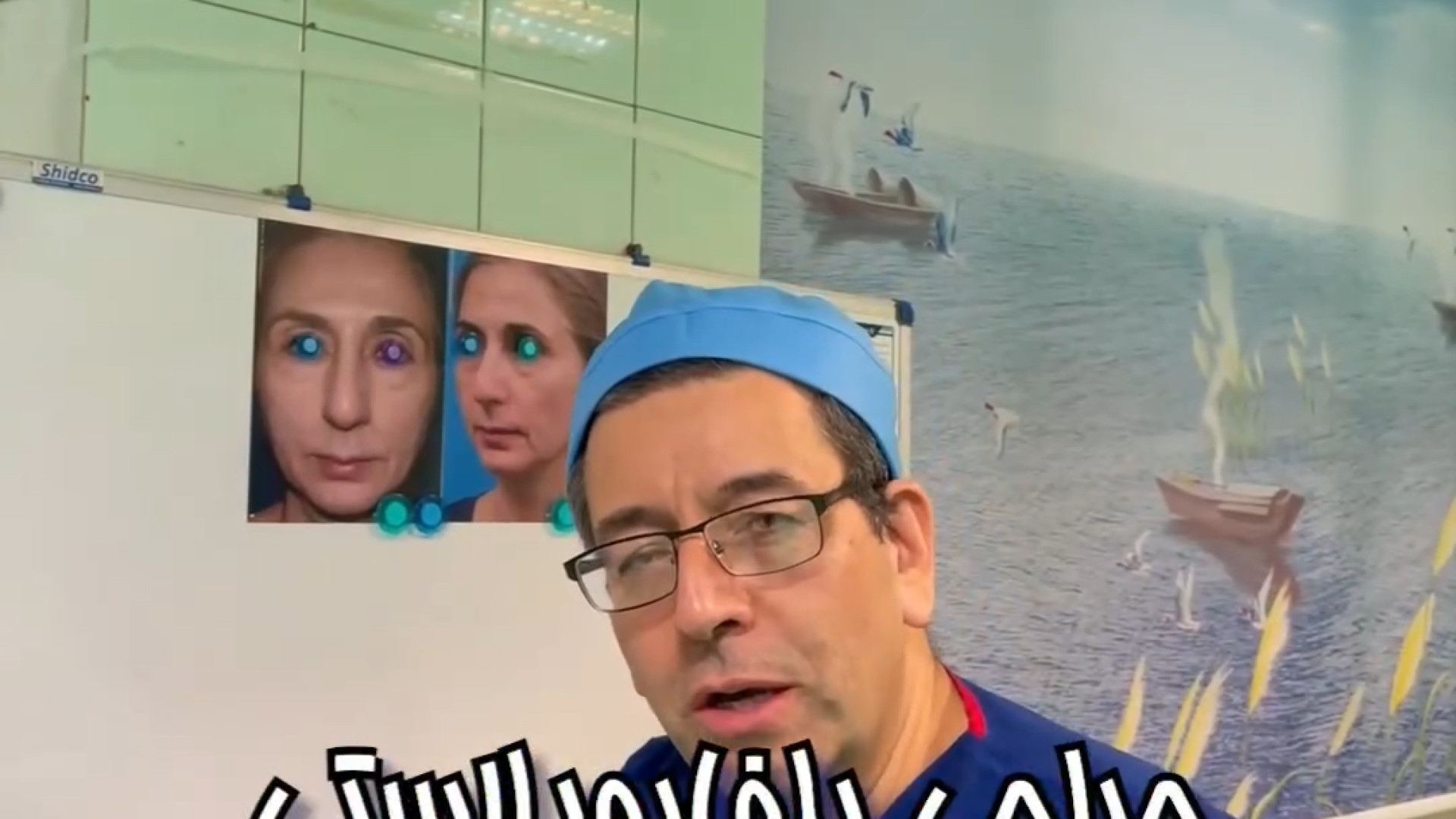 جراحی بلفاروپلاستی برای خانم ۵۴ ساله دکتر حمید رضا فتحی فوق تخصص جراحی پلاستیک