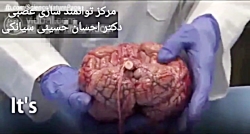 ویژگی های مغز انسان