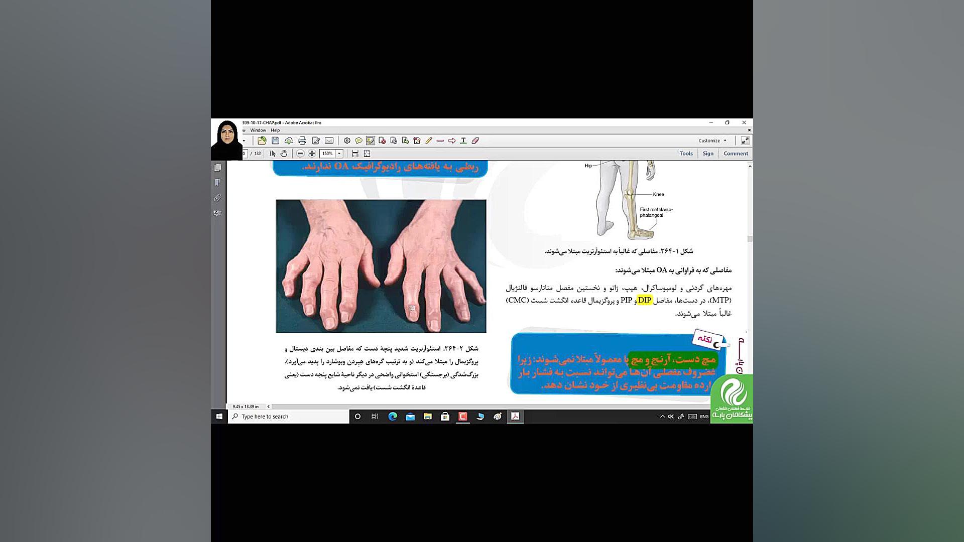نمونه تدریس مرور سریع بیماری های روماتیسمی و بافت همبند پارسه پله