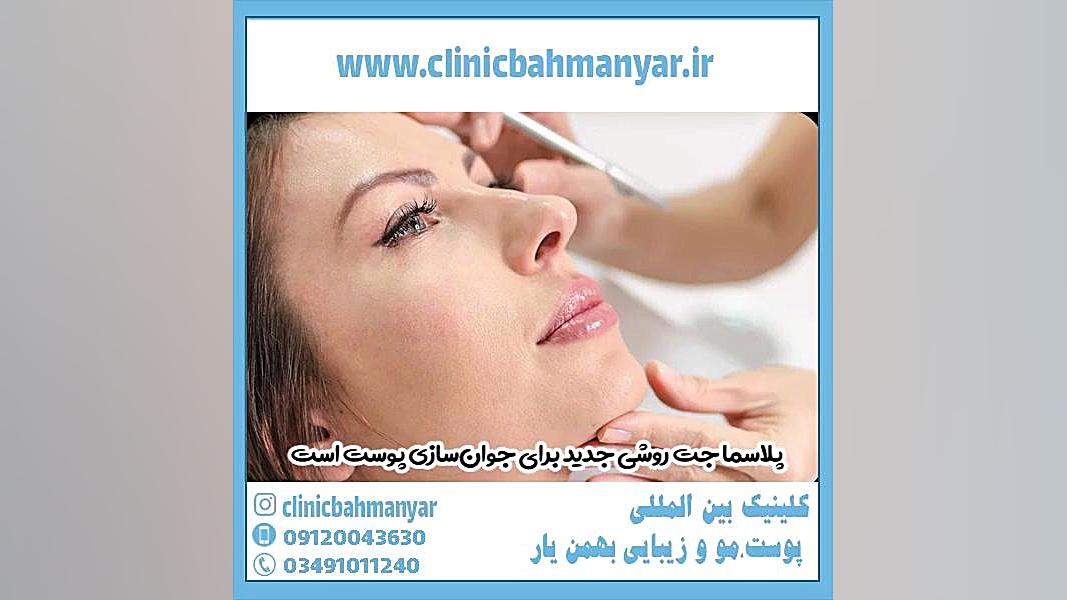 پلاسما جت صورت ارنیزوماب