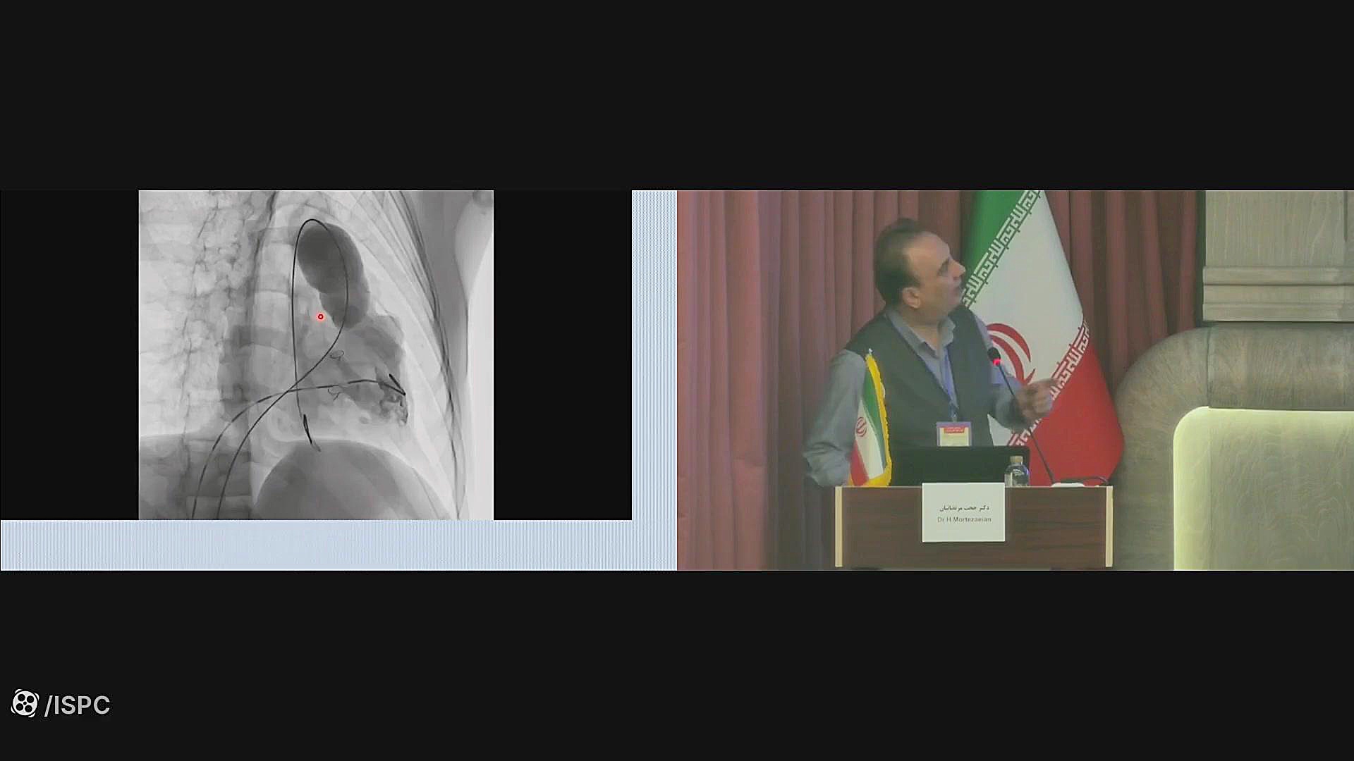 Trans-catheter PVR دکتر حجت مرتضاییان جراحی زیبایی پلک