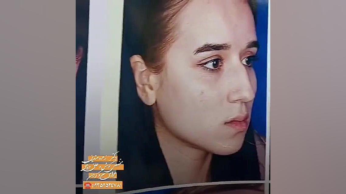 دکتر زهره متدین متخصص و جراح گوش،حلق،بینی پروتز سینه