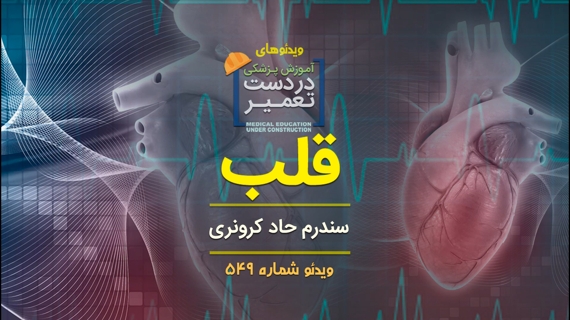 قلب (سندرم حاد کرونری) دکتر پوست