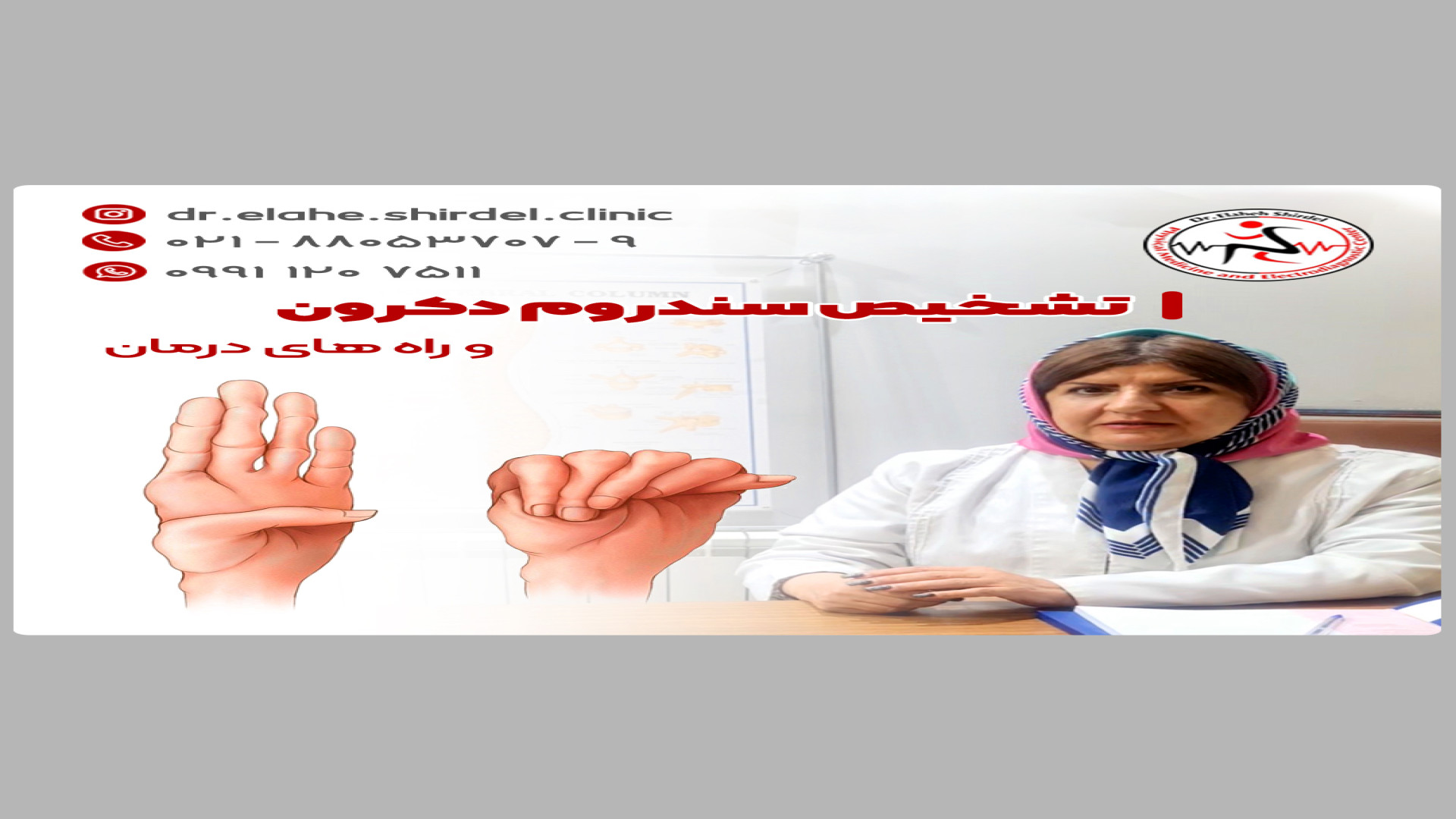 تشخیص سندروم دکرون و راه های درمان بیماری سندروم نوتان