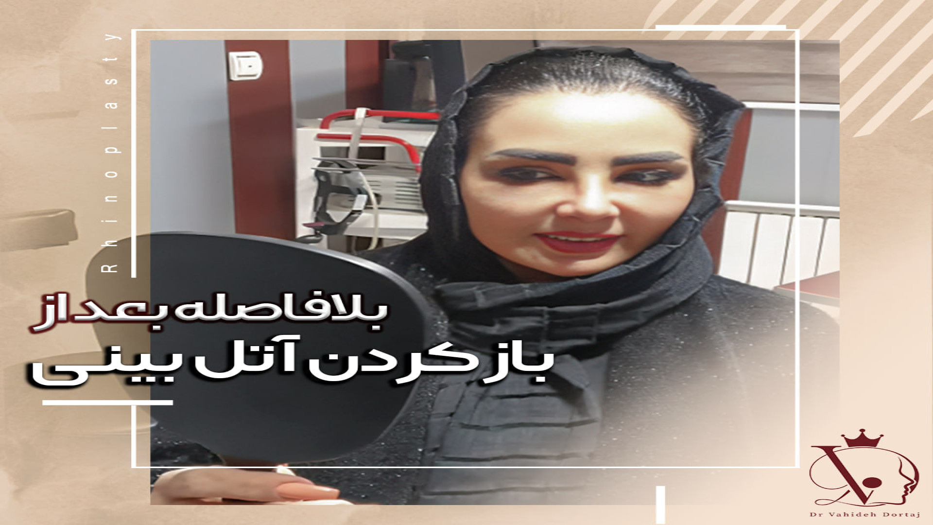 بلافاصله بعد از باز کردن آتل بینی اکستنشن تاج دندان