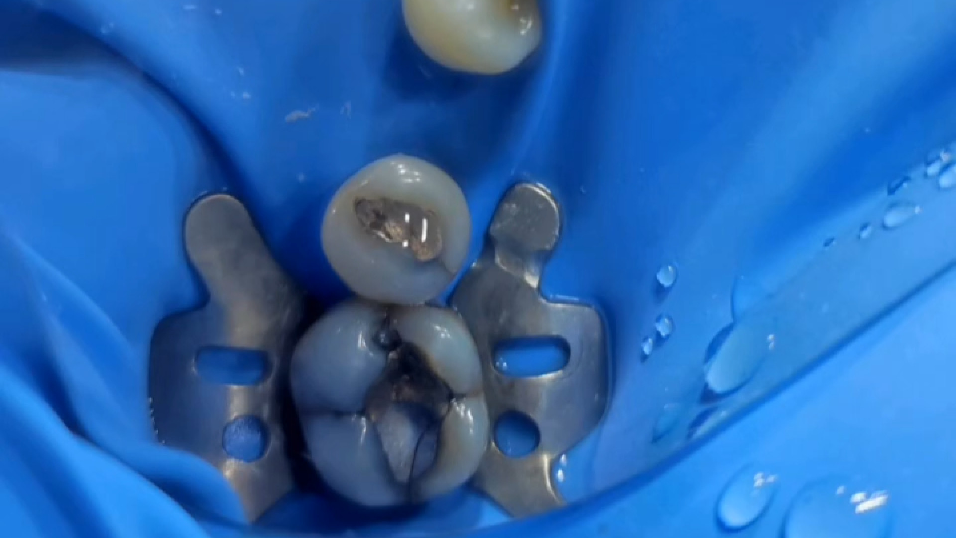 نمونه کار دکتر زهرا رخ افروز دکتر زهرا رخ فروز