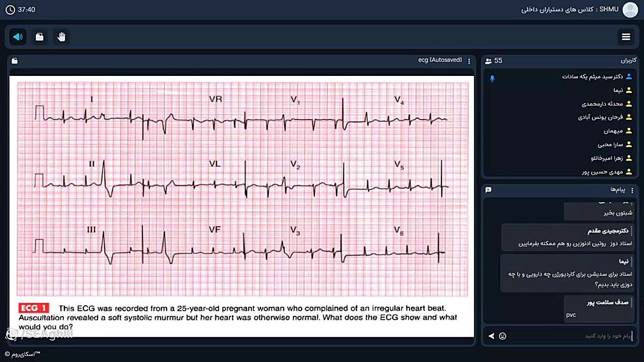 آشنایی با ECG های اورژانسی و درمان اورژانسی آنها - دکتریکه سادات -جلسه اول جراحی لثه