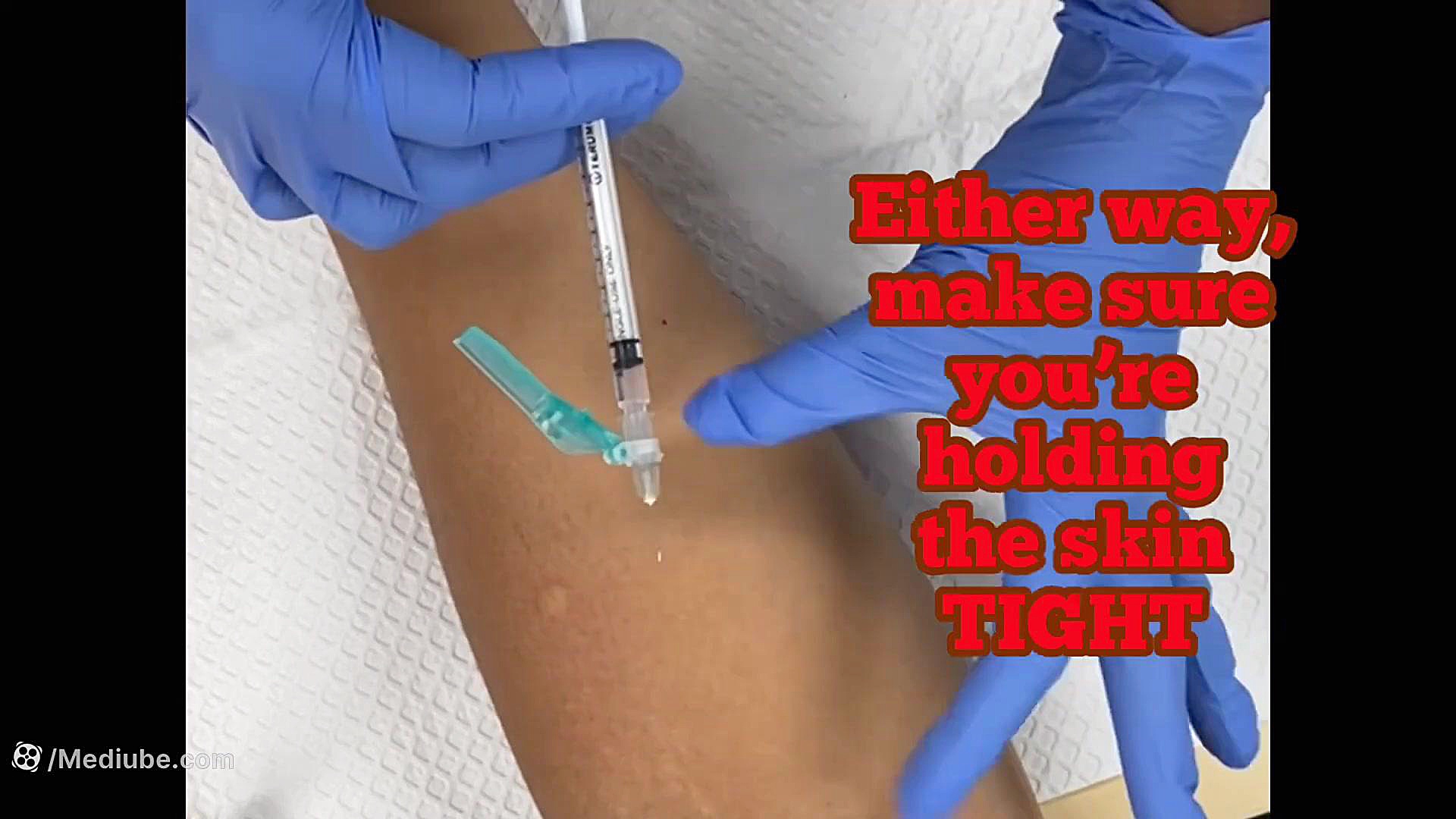 How To Give an Intradermal Injection | PPD | TB Test | Medical Assisting ولاگر