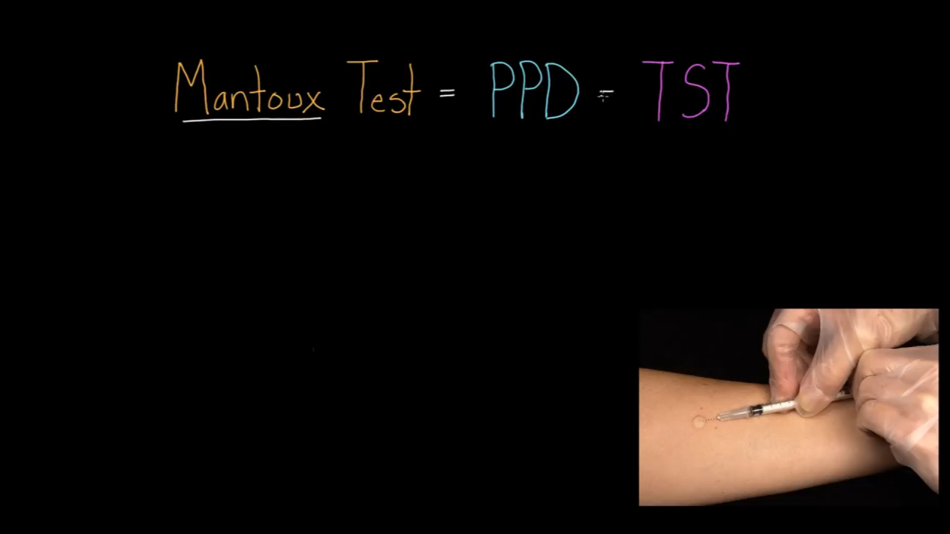 Mantoux Test (aka. PPD or TST) گیم‌پلی کله‌خراب