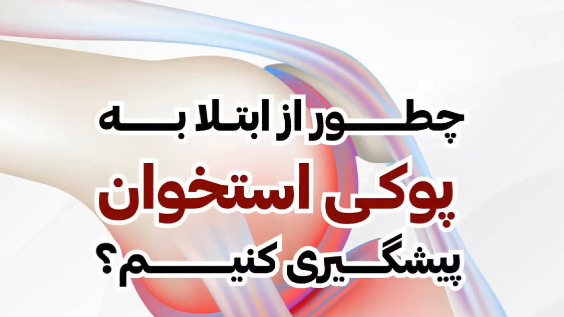 جلوگیری از پوکی استخوان دکتر مهران زمان زاده متخصص غدد