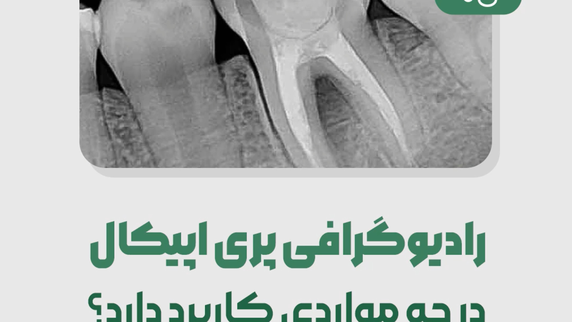 رادیوگرافی پری اپیکال در چه مواردی کاربرد دارد؟ رادیولوژی دهان، فک و صورت دکتر مریم زنگوئی بوشهری