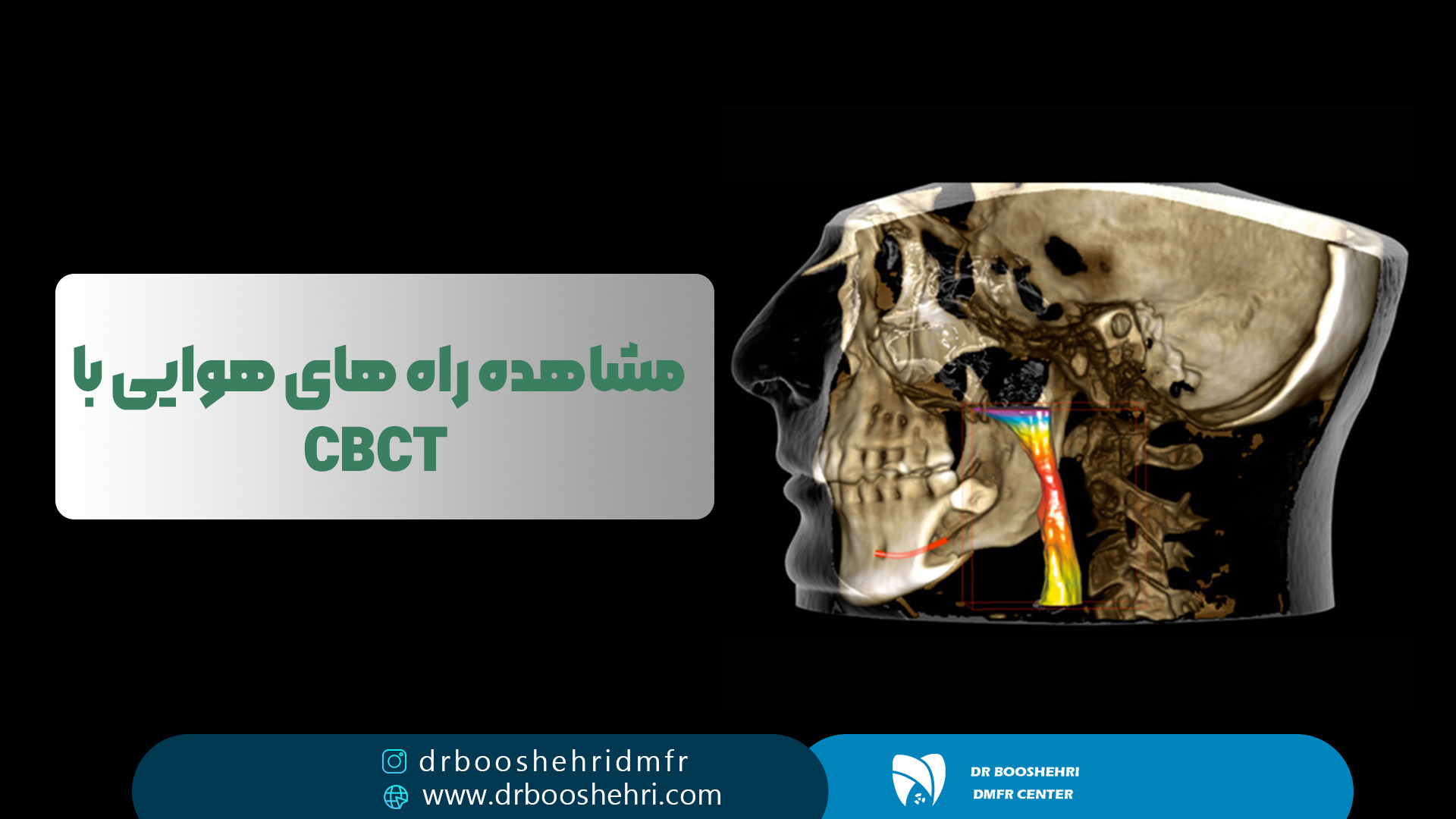 مشاهده راه های هوایی با CBCT رادیولوژی دهان، فک و صورت دکتر مریم زنگوئی بوشهری