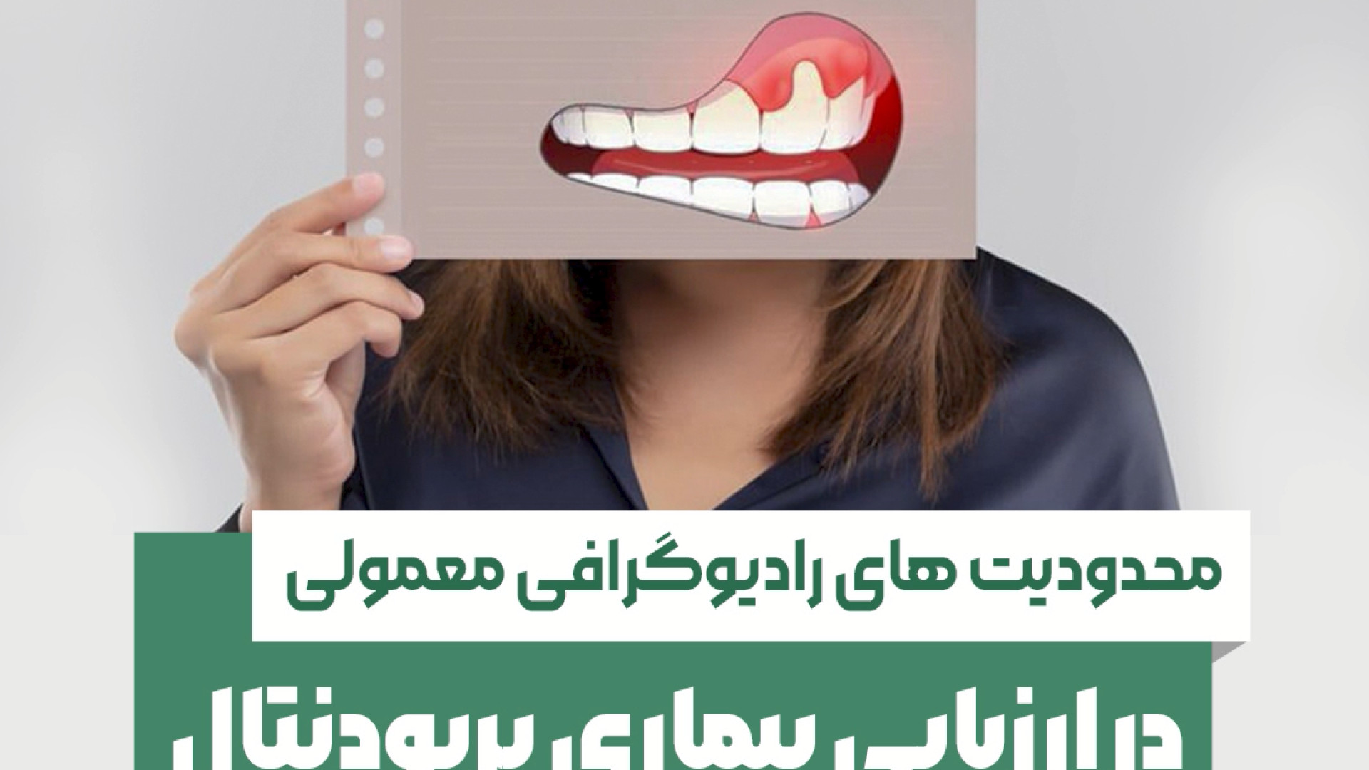 محدودیت های رادیوگرافی معمولی در ارزیابی بیماری پریودنتال رادیولوژی دهان، فک و صورت دکتر مریم زنگوئی بوشهری