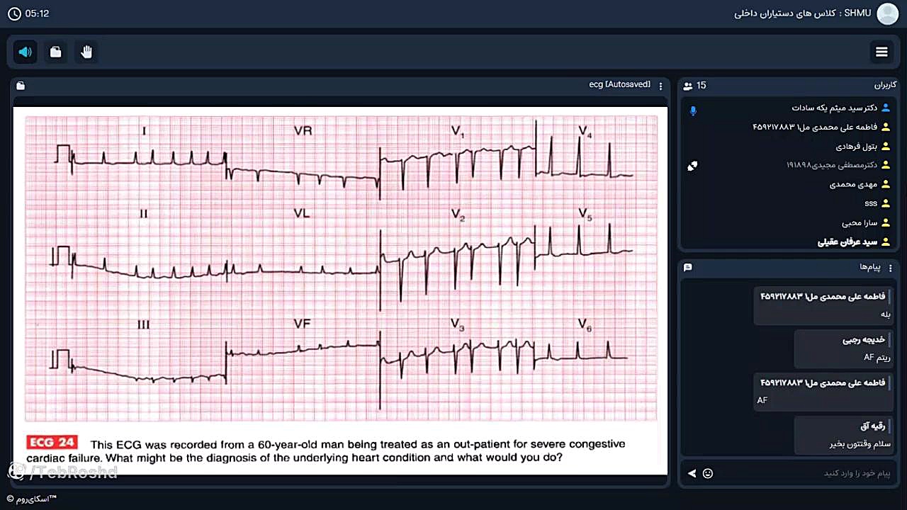 آشنایی با ECG های اورژانسی و درمان اورژانسی آنها - دکتریکه سادات -جلسه دوم جراحی زیبایی پلک