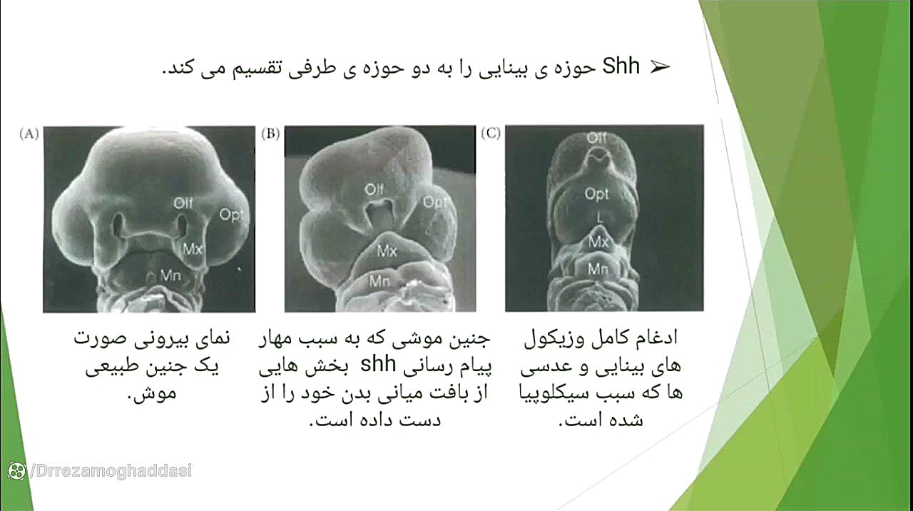 تکوین چشم روکش دندان